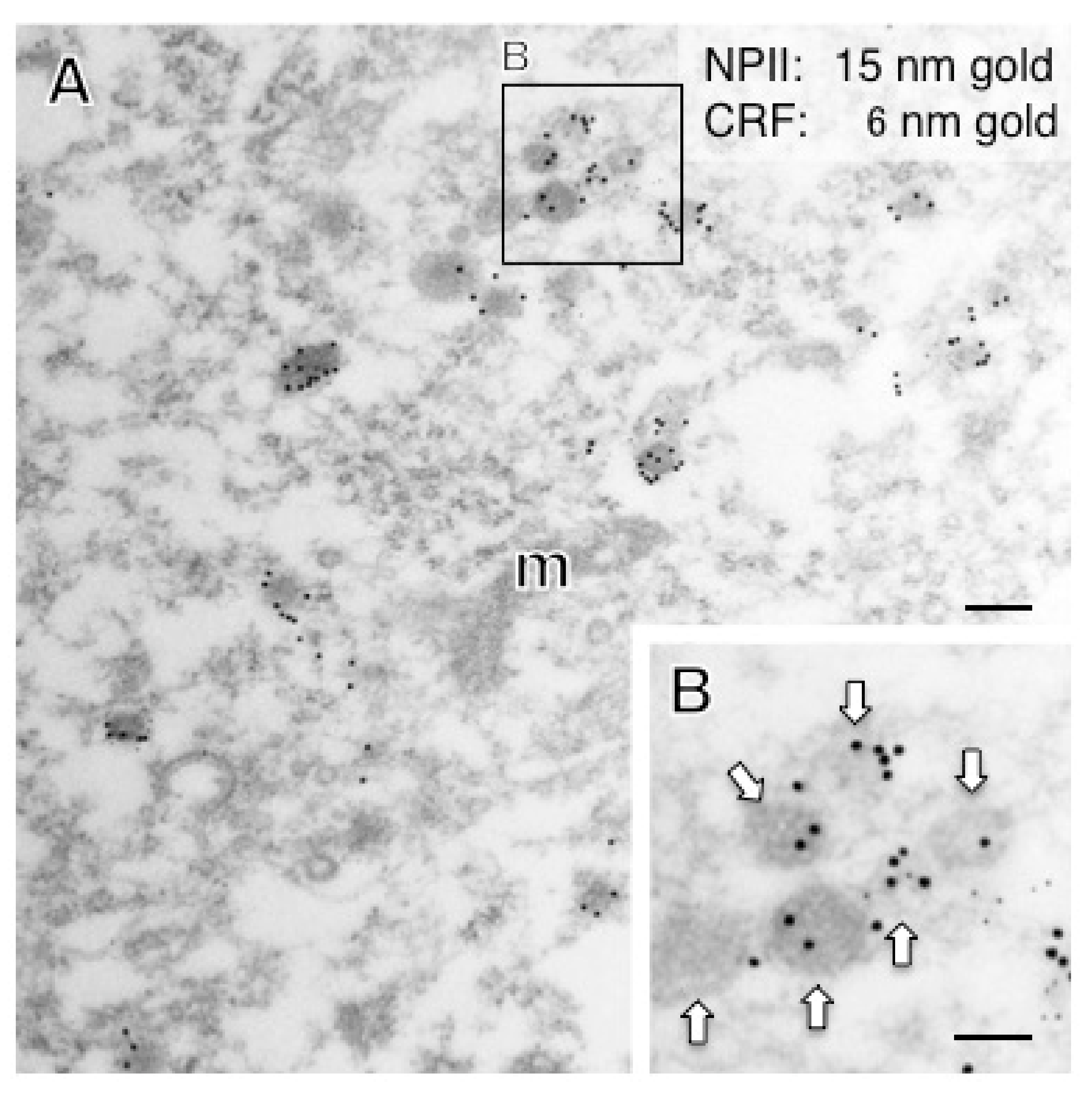 Ijms 22 09180 g011 550