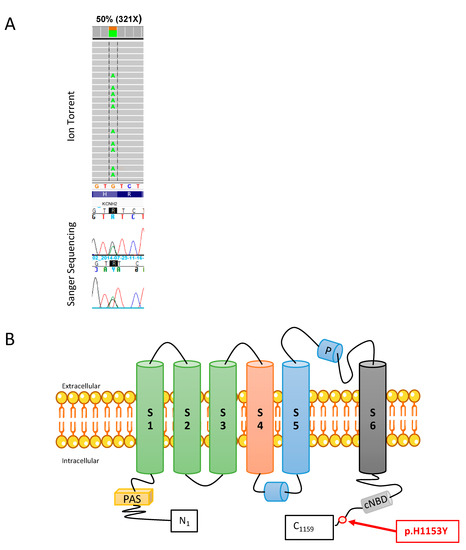 IJMS | Free Full-Text | H1153Y-KCNH2 Mutation Identified In A.