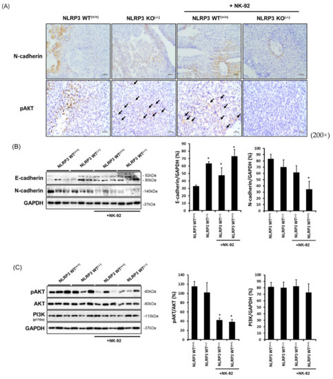 NLRP3 Deficiency in Hepatocellular Carcinoma Enhances