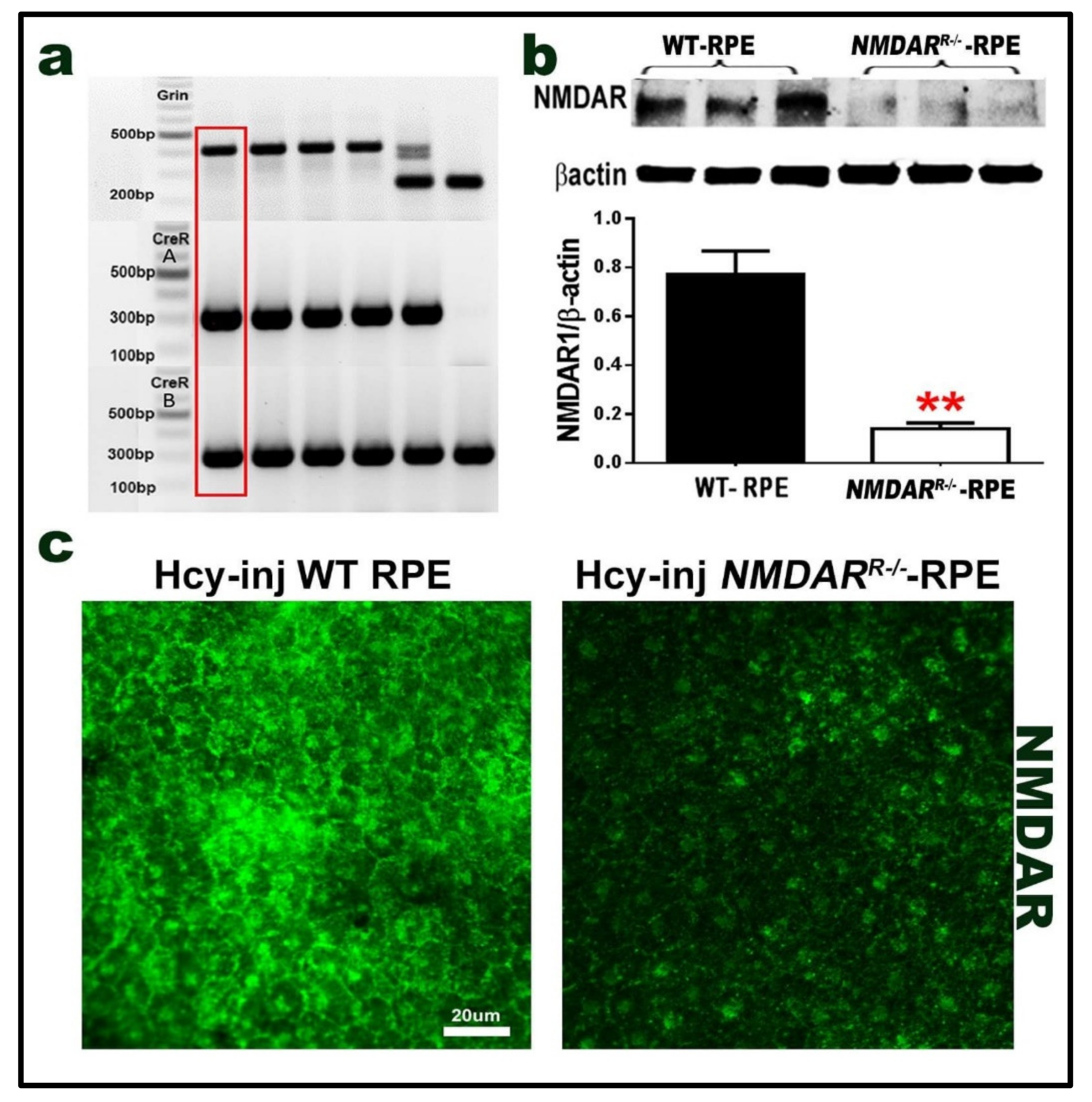 Ijms 22 09356 g004 Ijms 22 09356 g004