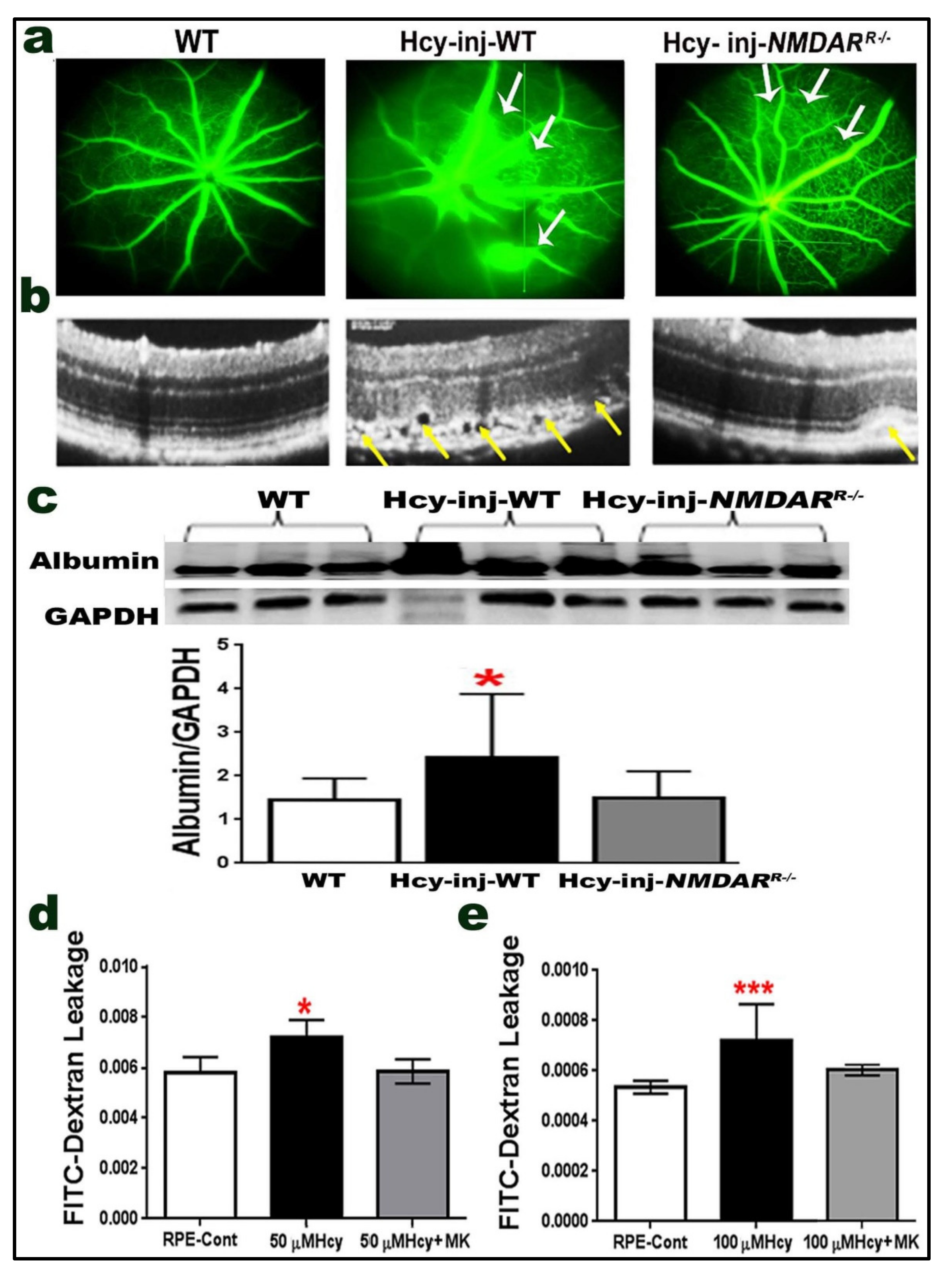 Ijms 22 09356 g005 Ijms 22 09356 g005