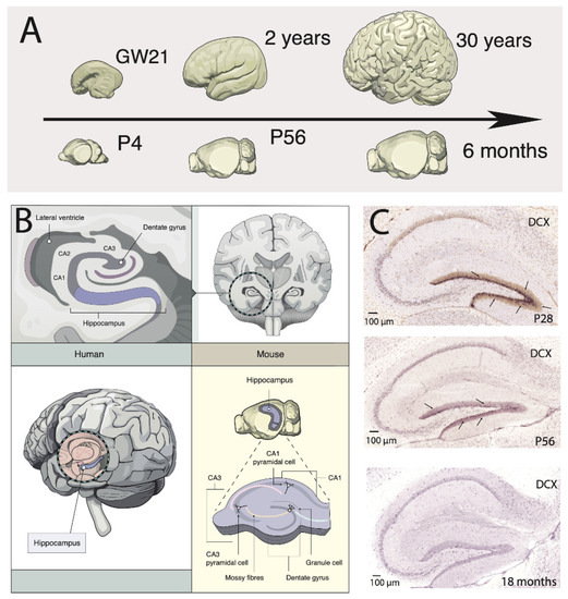 洋書 Plasticity in the Human Nervous System Brain Plasticity in Humans and Model Systems: Advances