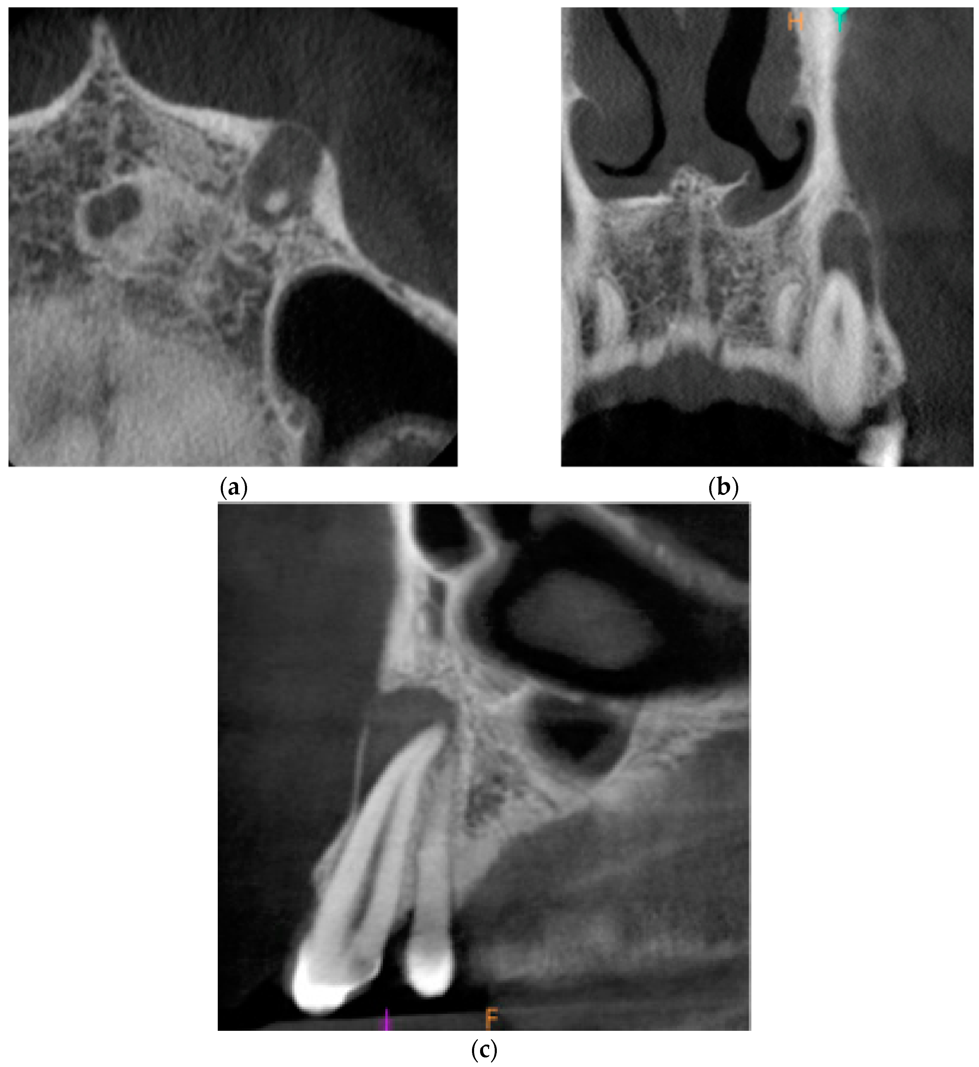 Ijms 22 09458 g005 550