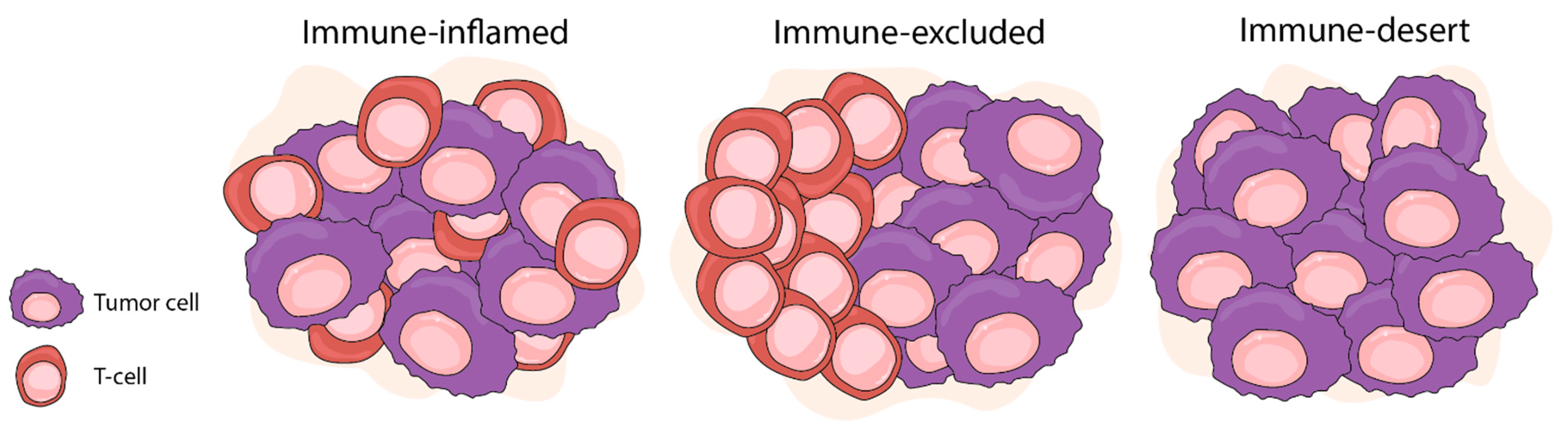 IJMS Free Full-Text The Role of Somatic Mutations on the Immune Response of the Tumor Microenvironment in Prostate Cancer image image