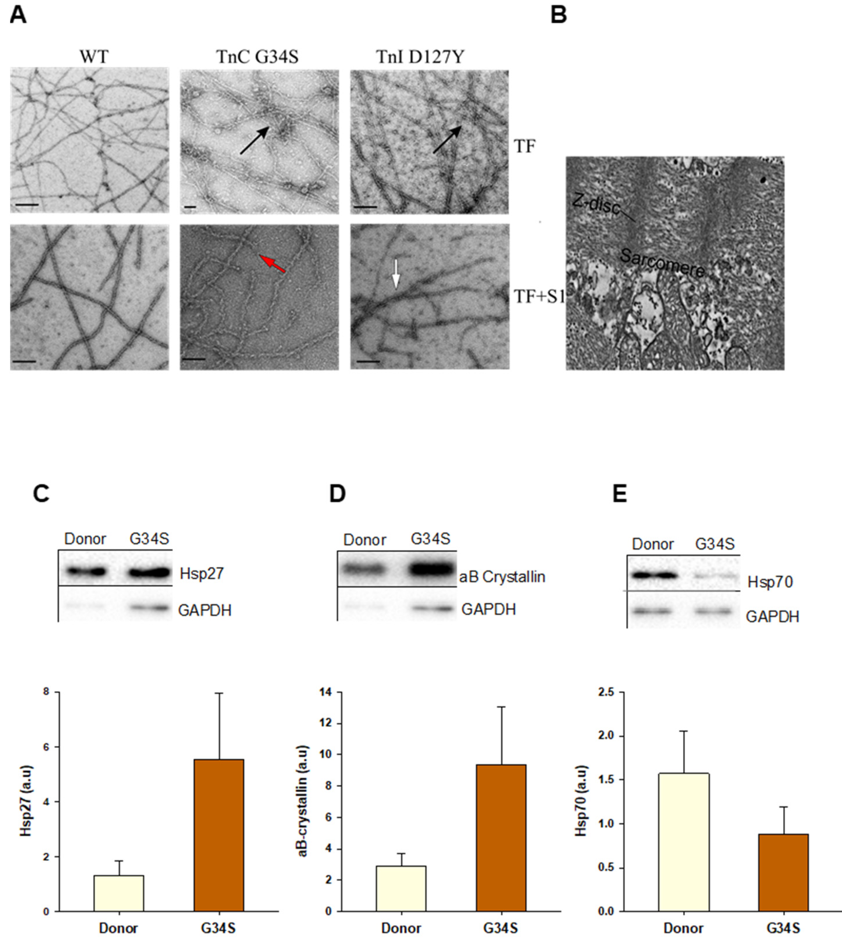 Ijms 22 09625 g005 Ijms 22 09625 g005