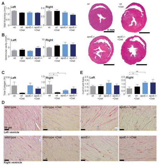 Ijms Free Full Text Apolipoprotein E4 Is Associated With Right Ventricular Dysfunction In Dilated Cardiomyopathy An Animal And In Human Comparative Study Html