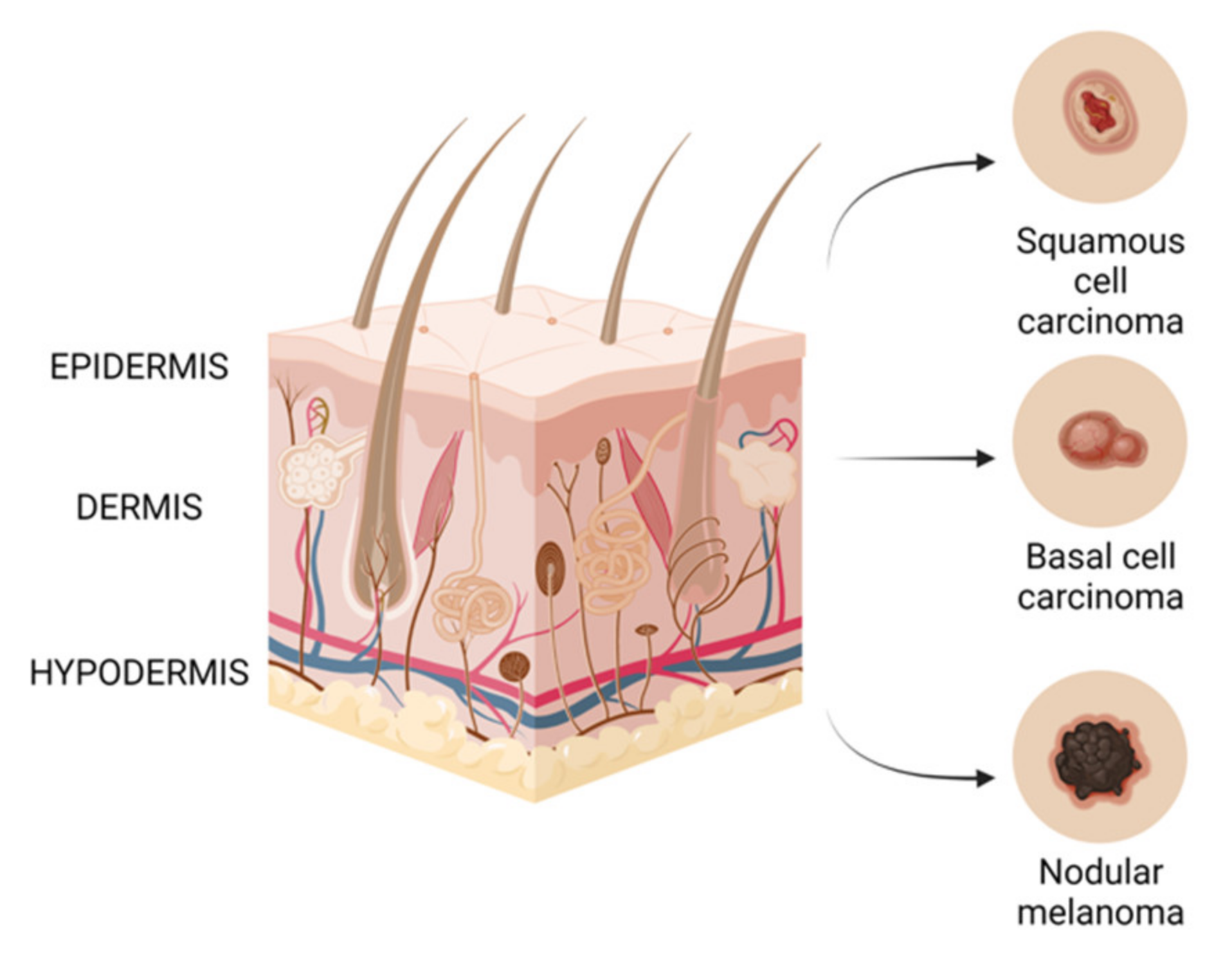 Ijms | Free Full-Text | Recent Advances In Phenolic Metabolites And Skin  Cancer | Html
