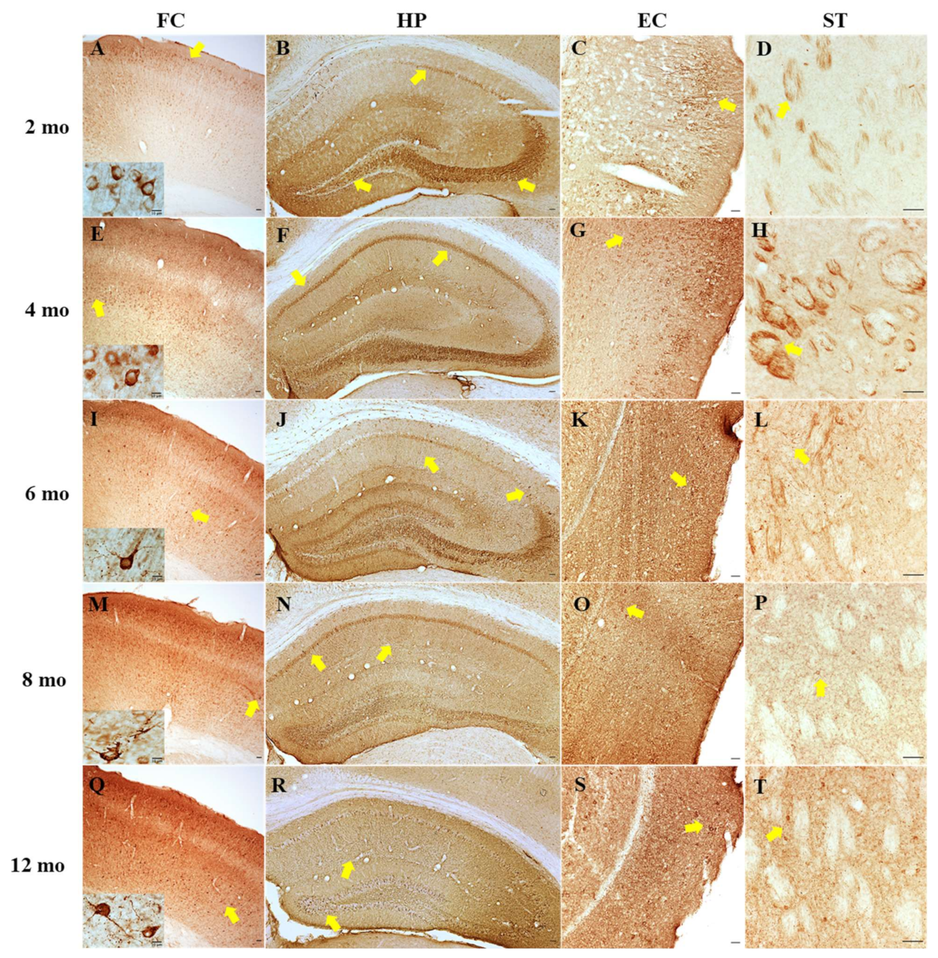 Ijms 22 09727 g008 550