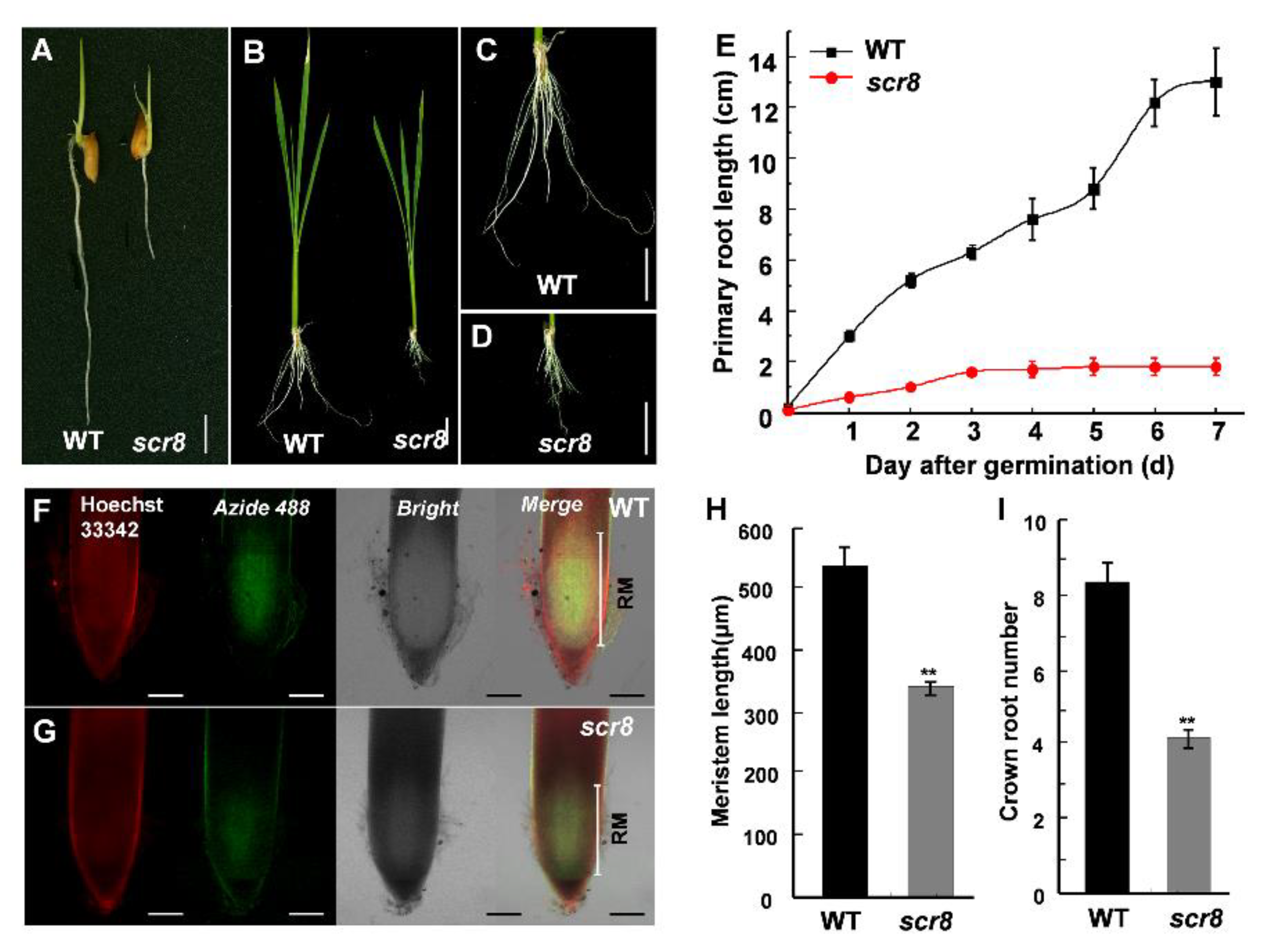 Ijms Free Full Text Identification And Characterization Of Short Crown Root 8 A Temperature Sensitive Mutant Associated With Crown Root Development In Rice Html Ijms Free Full Text Identification And Characterization Of Short Crown Root 8 A Temperature Sensitive Mutant Associated With Crown Root Development In Rice Html