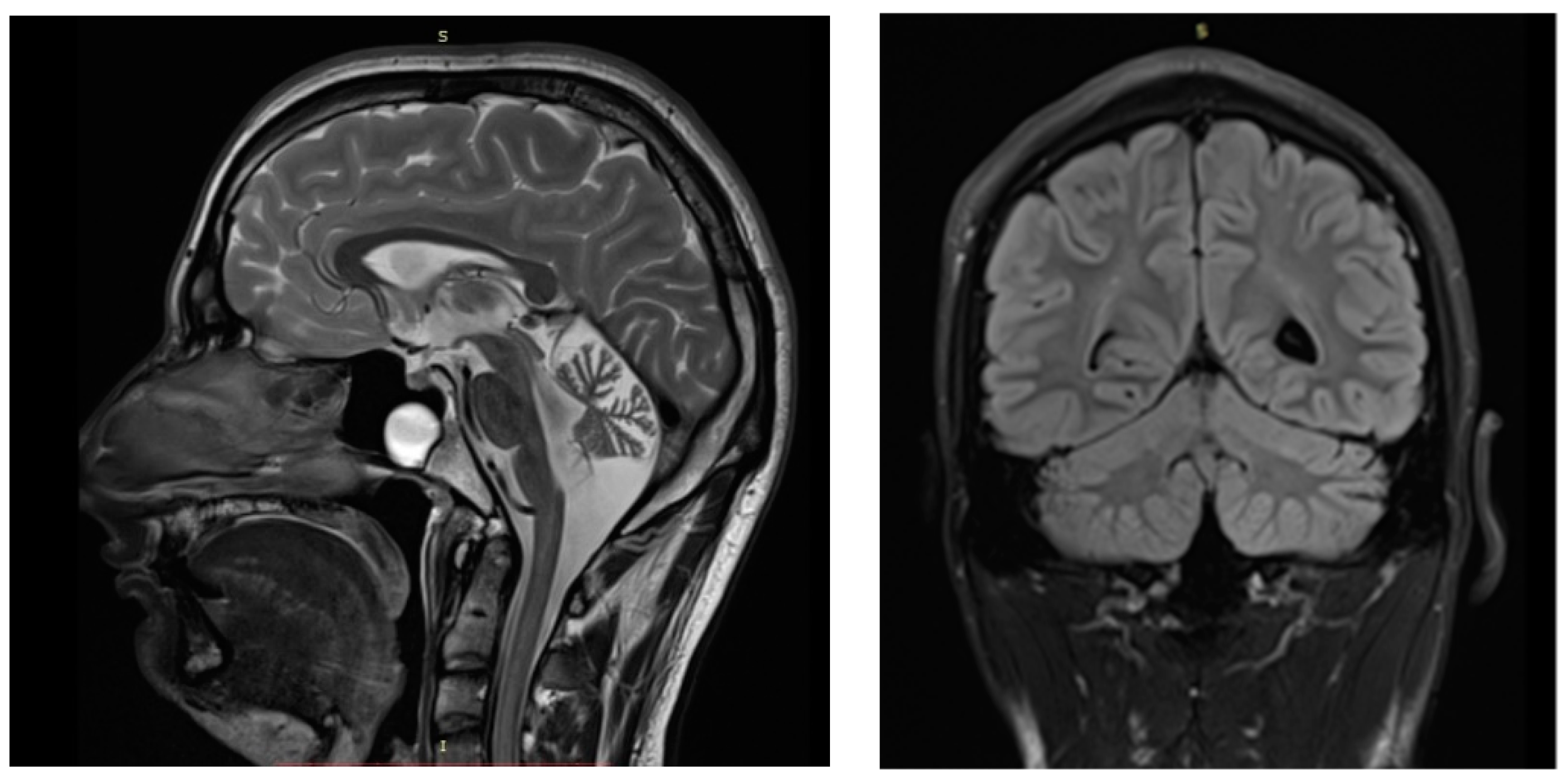 Ijms 22 09913 g001 550