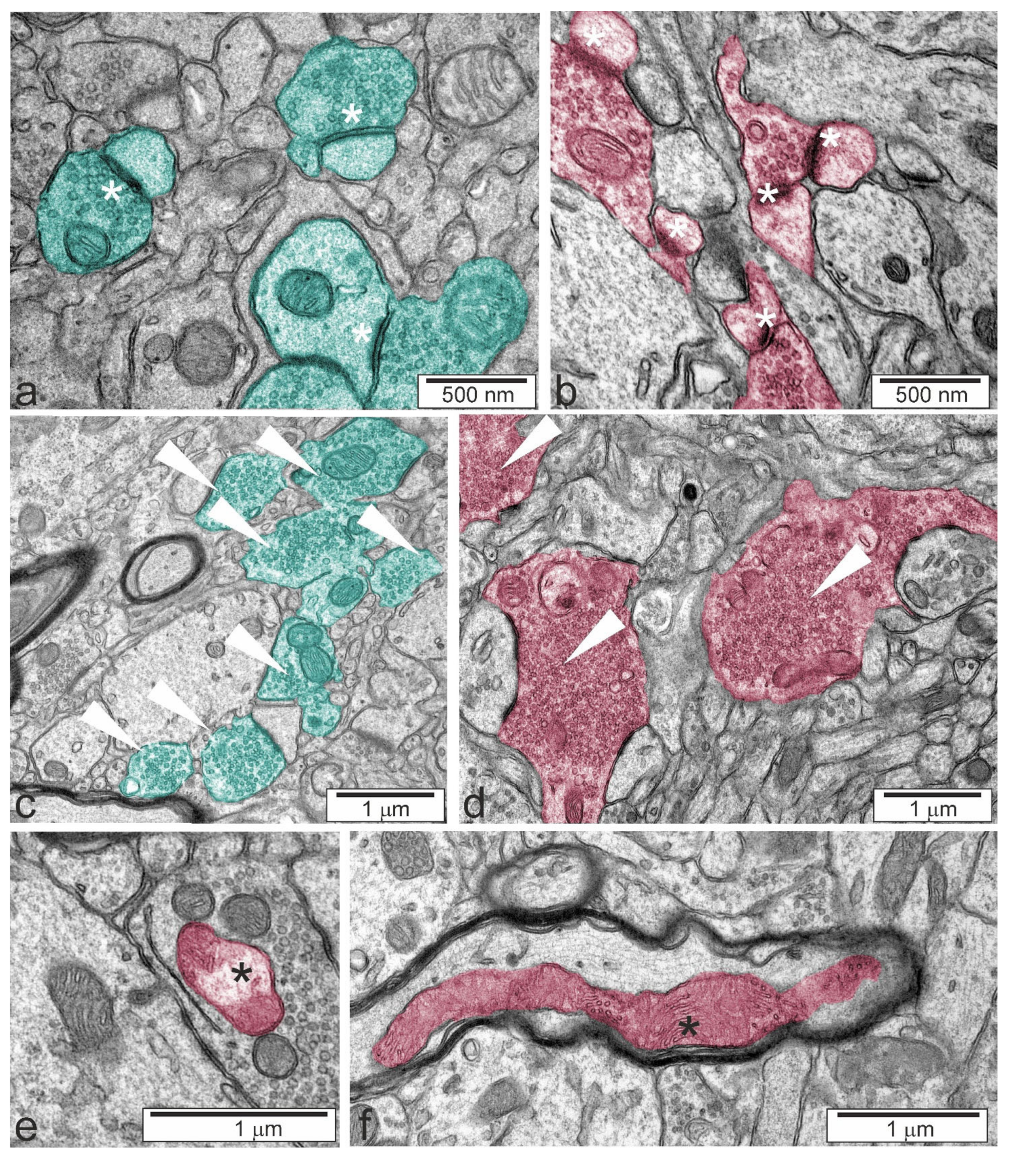 Ijms 22 10058 g004 Ijms 22 10058 g004