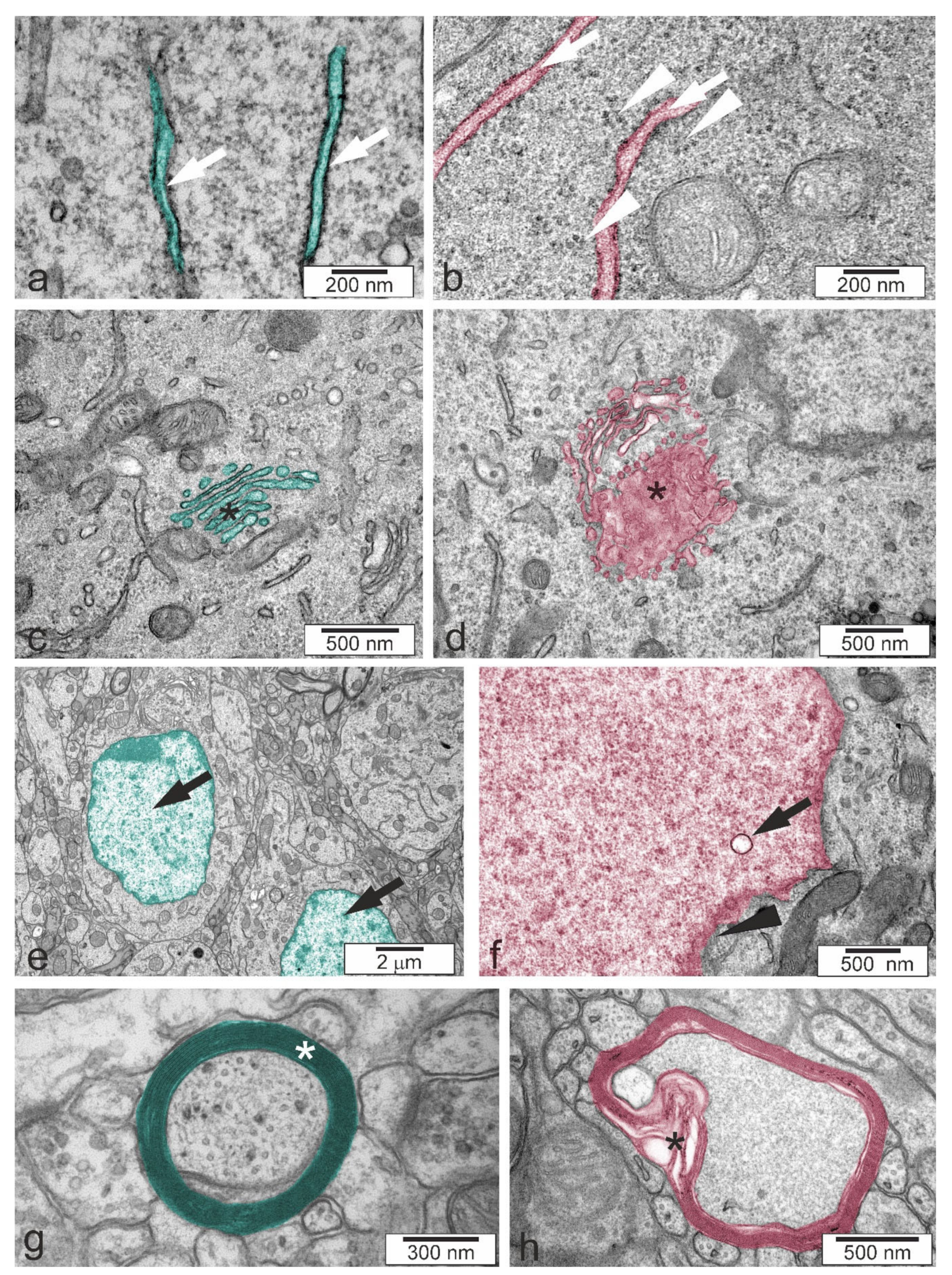 Ijms 22 10058 g005 Ijms 22 10058 g005