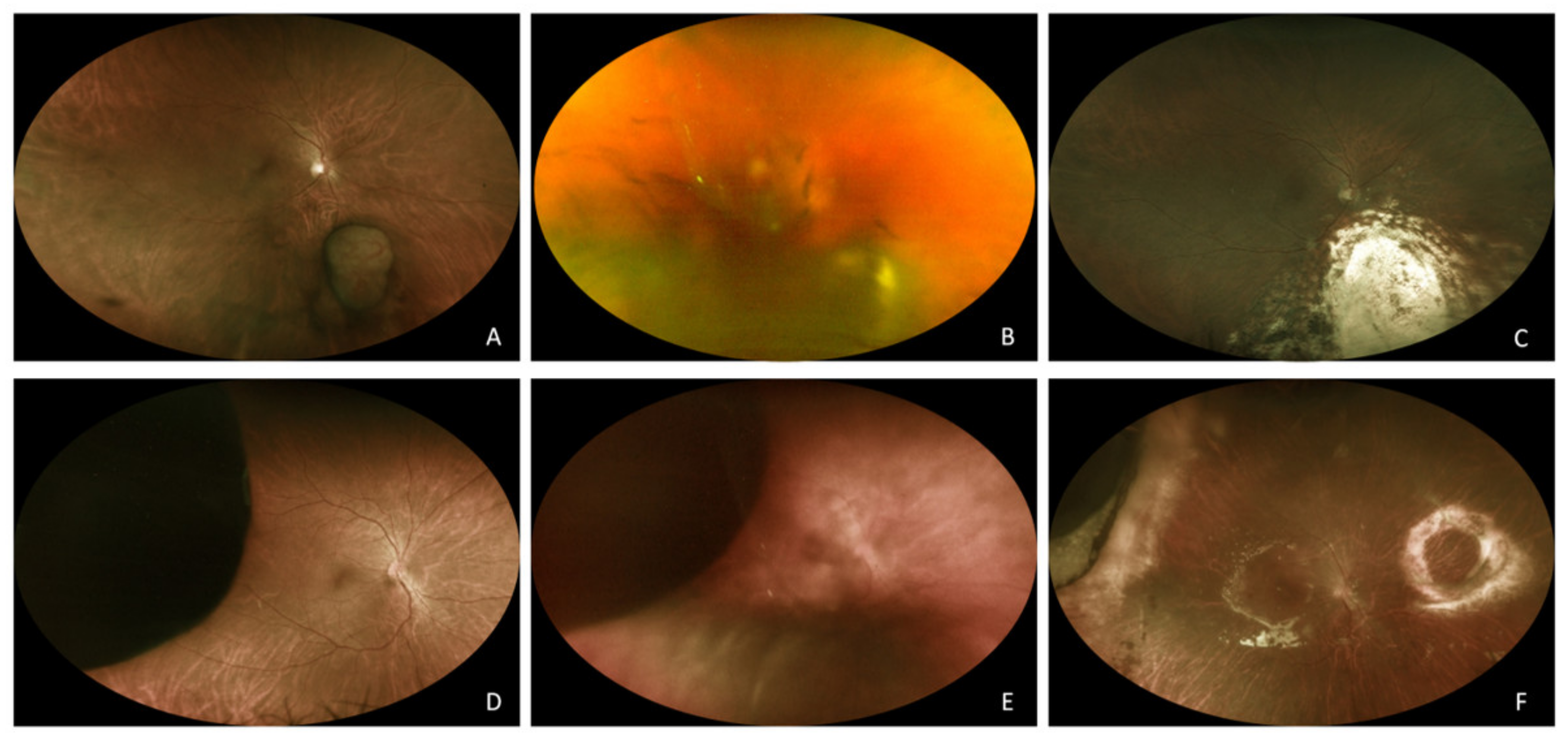 Ijms 22 10066 g001 550