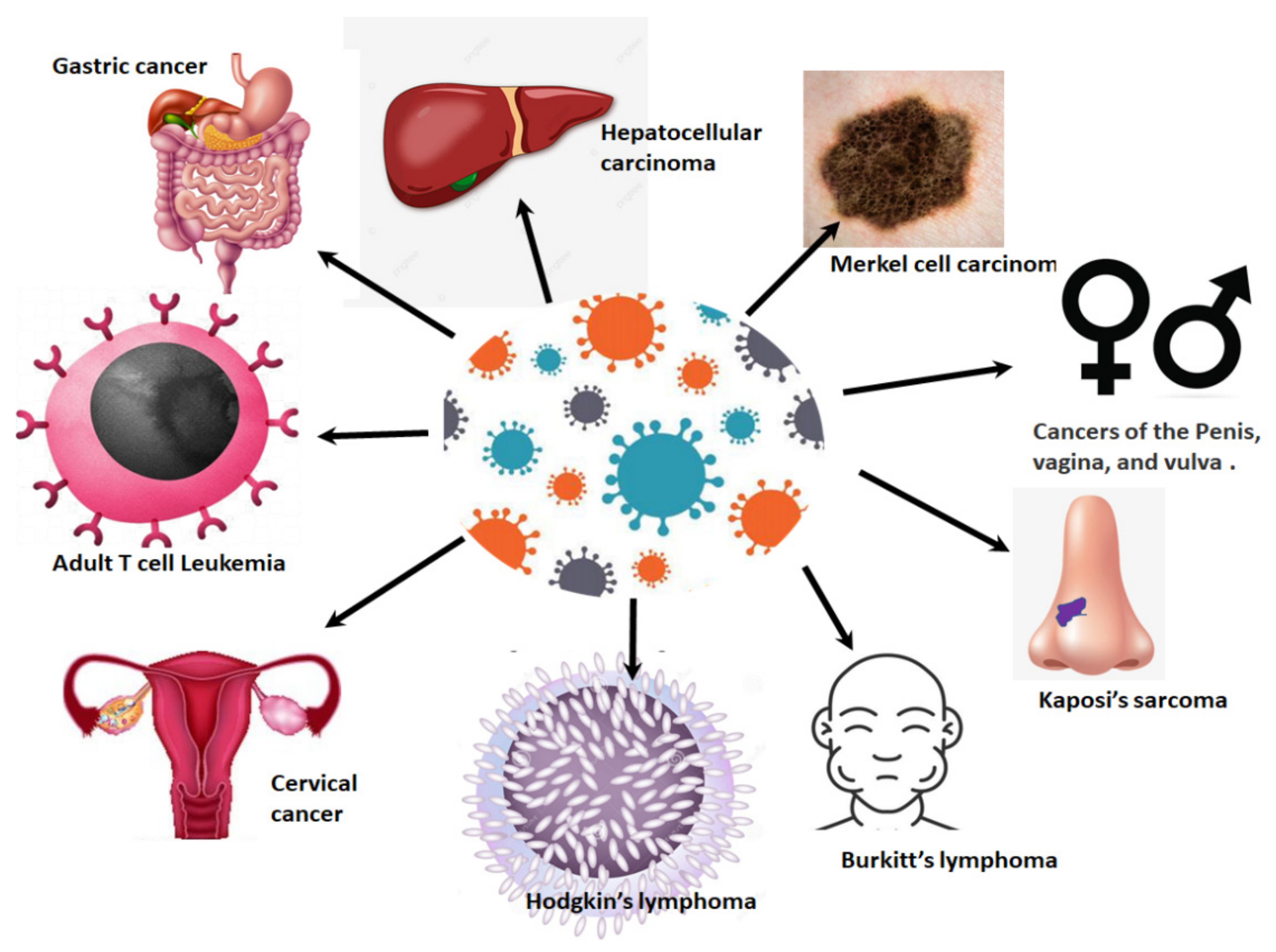 papilloma virus o herpes)