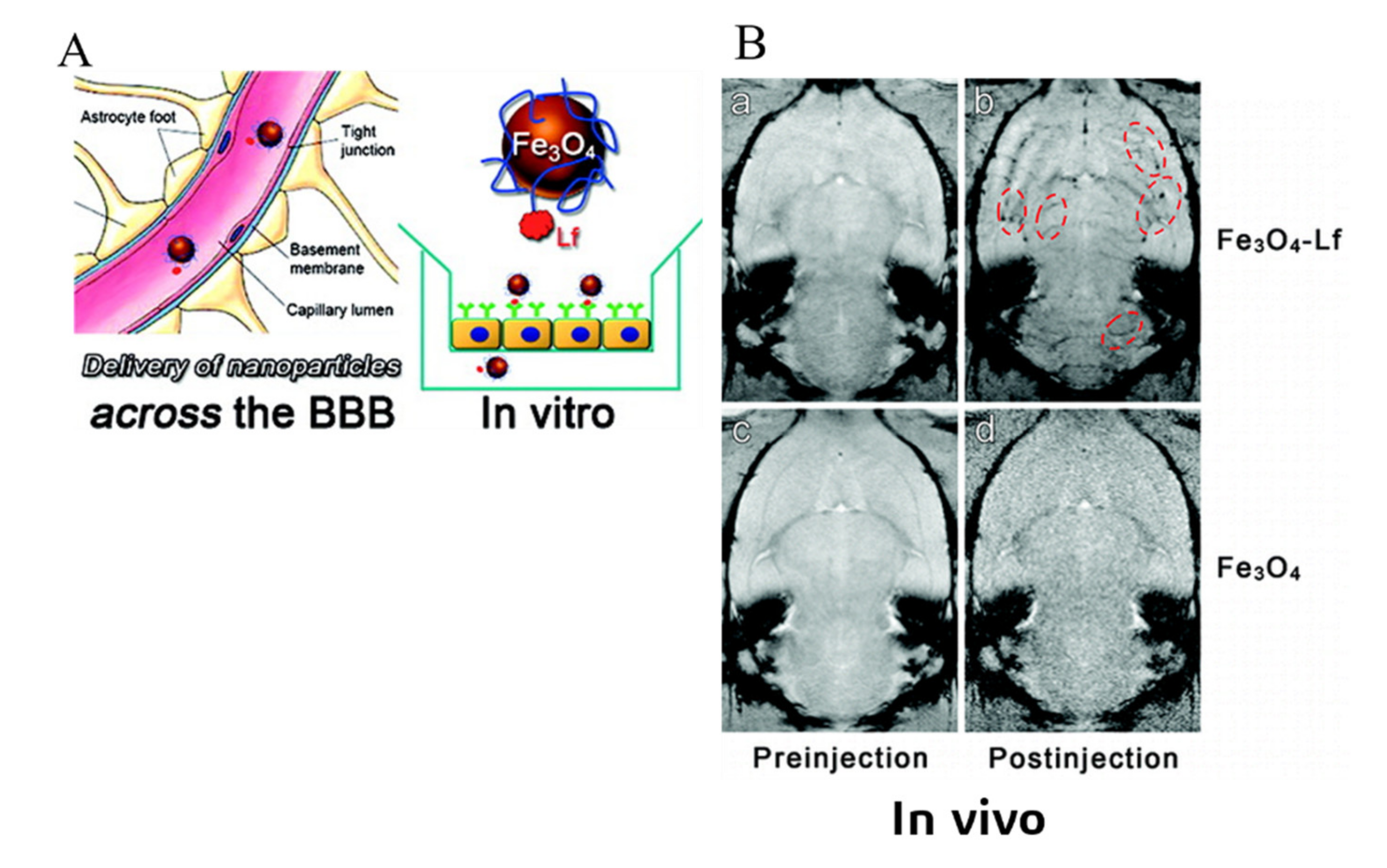Design and Development of Nanomaterial-Based Drug Carriers