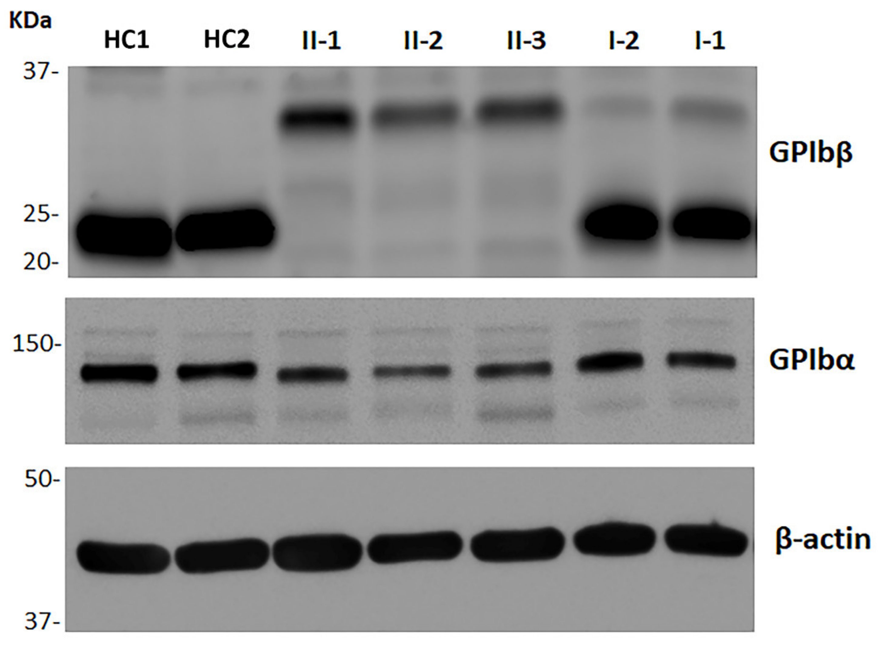 Ijms 22 10190 g002 550