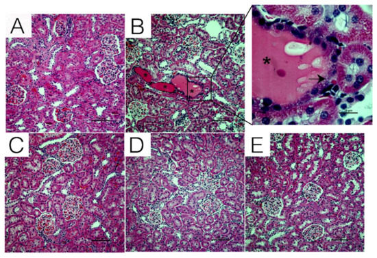 Chrysin Ameliorates Cyclosporine-A-Induced Renal Fibrosis by