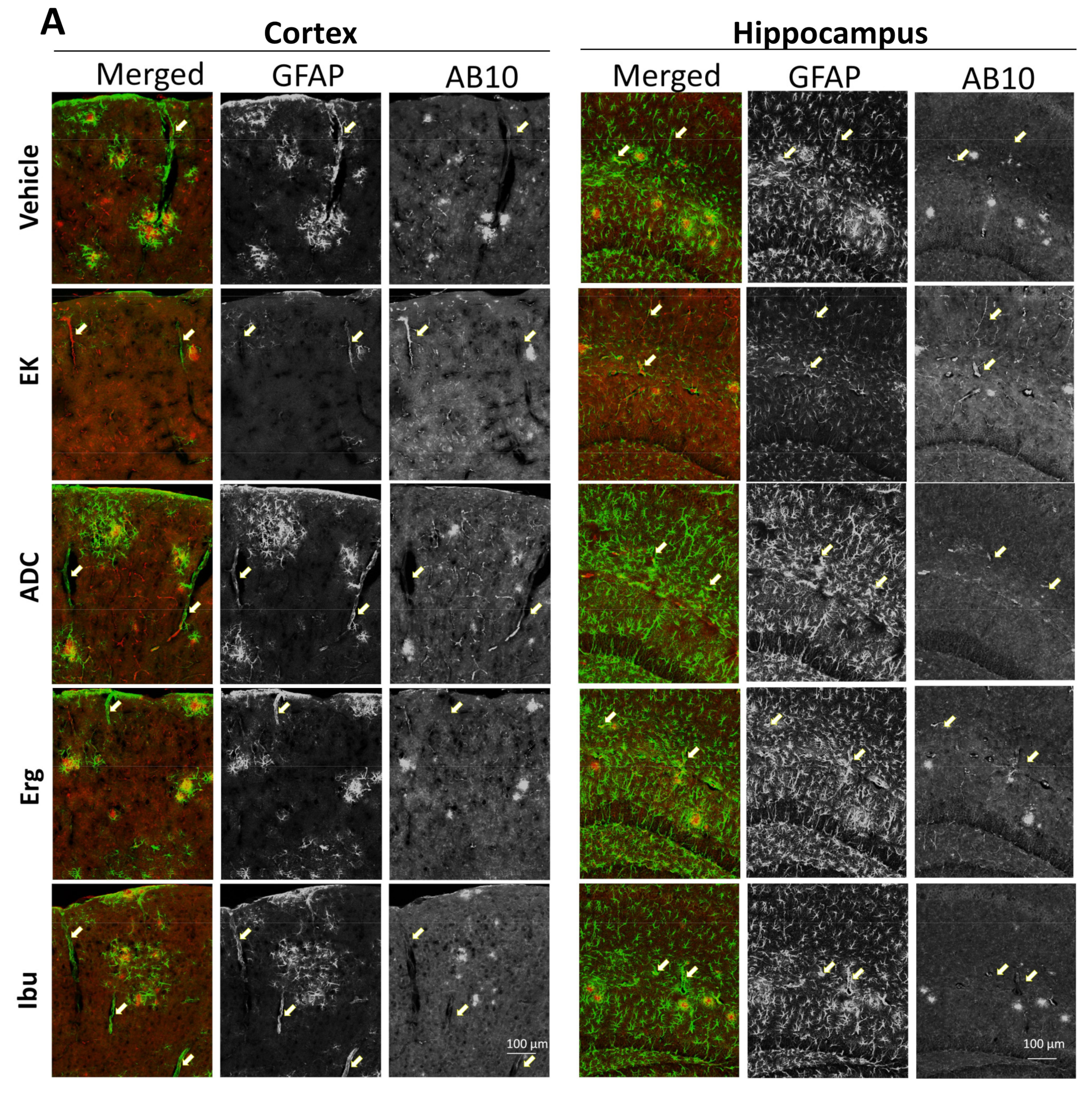 Ijms 22 10413 g004a 550