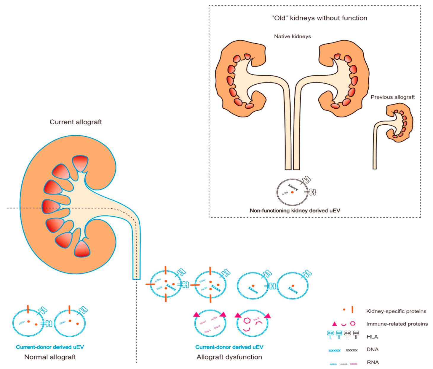 IJMS Free FullText Urinary Extracellular Vesicles Are a Novel Tool