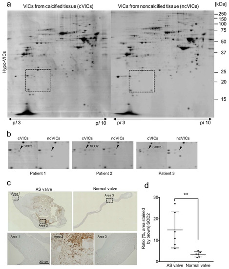 Hypoxic Culture Maintains Cell Growth of the Primary Human