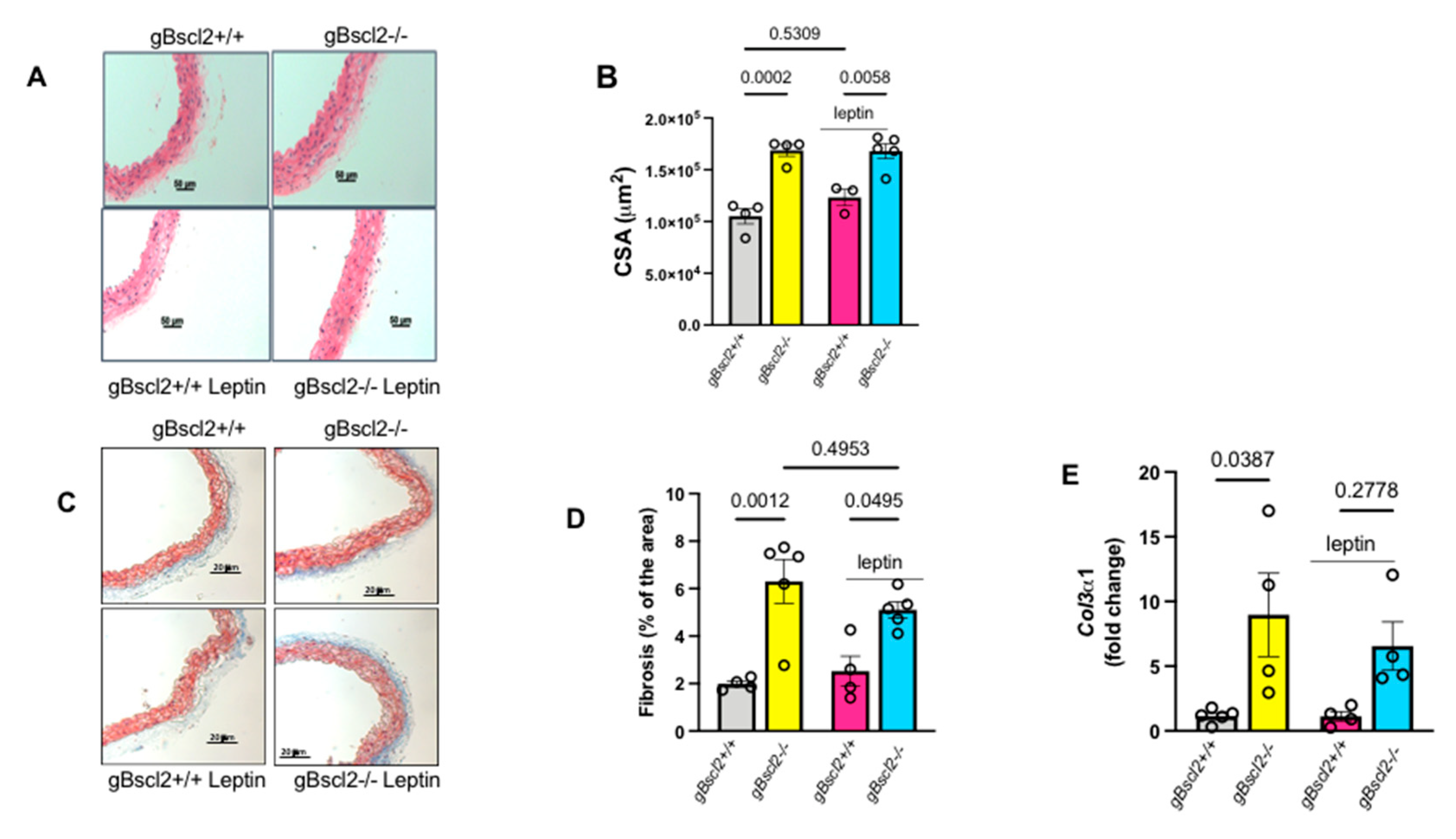 atmosphere Reduced Endothelial Leptin Signaling Increases Vascular