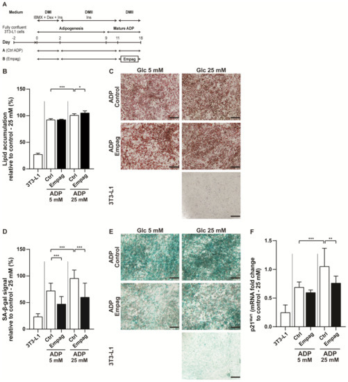 Complex Positive Effects of SGLT-2 Inhibitor Empagliflozin in the
