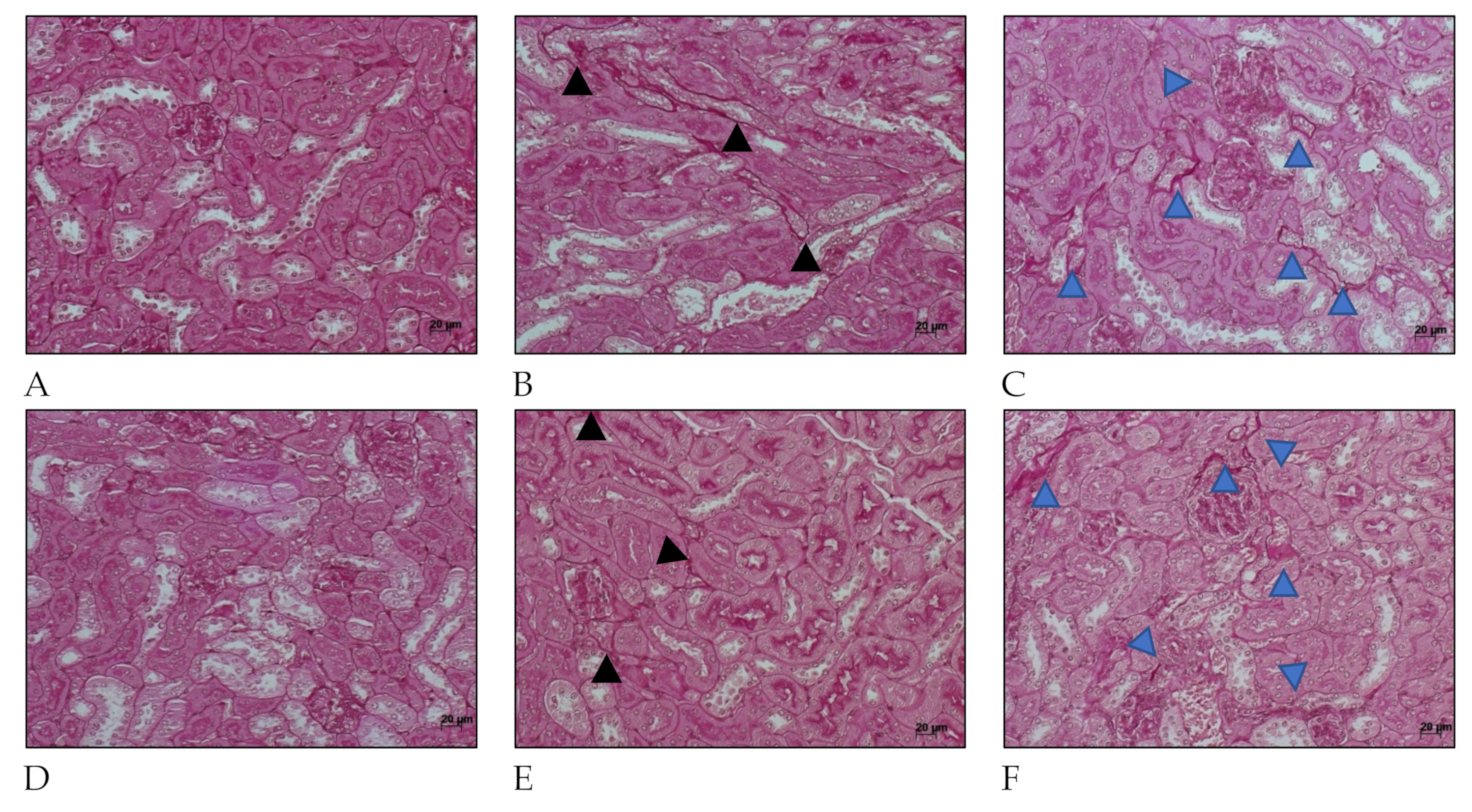 Ijms Free Full Text Understanding The Renal Fibrotic Process In Leptospirosis Html