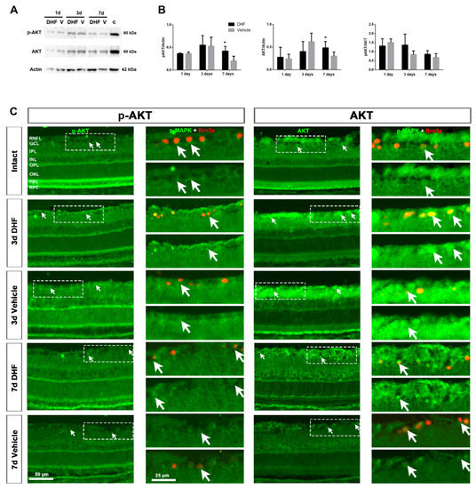 7,8-Dihydroxiflavone Protects Adult Rat Axotomized Retinal Ganglion ...