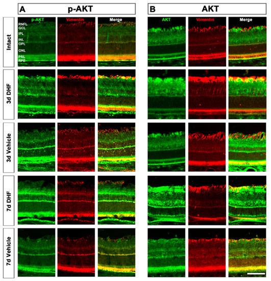 7,8-Dihydroxiflavone Protects Adult Rat Axotomized Retinal Ganglion ...