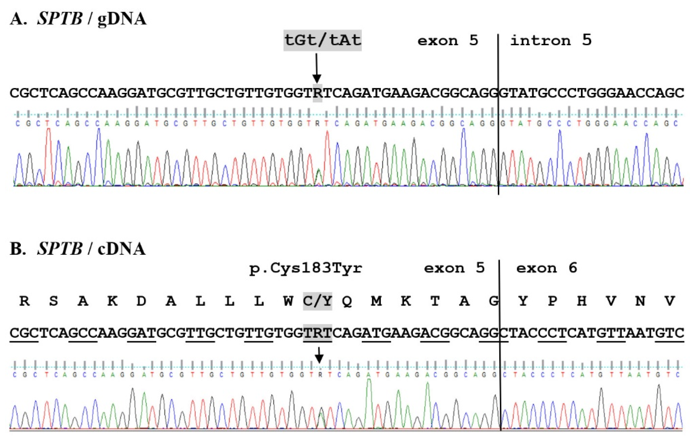 IJMS Free FullText Identification of a Novel Mutation of β