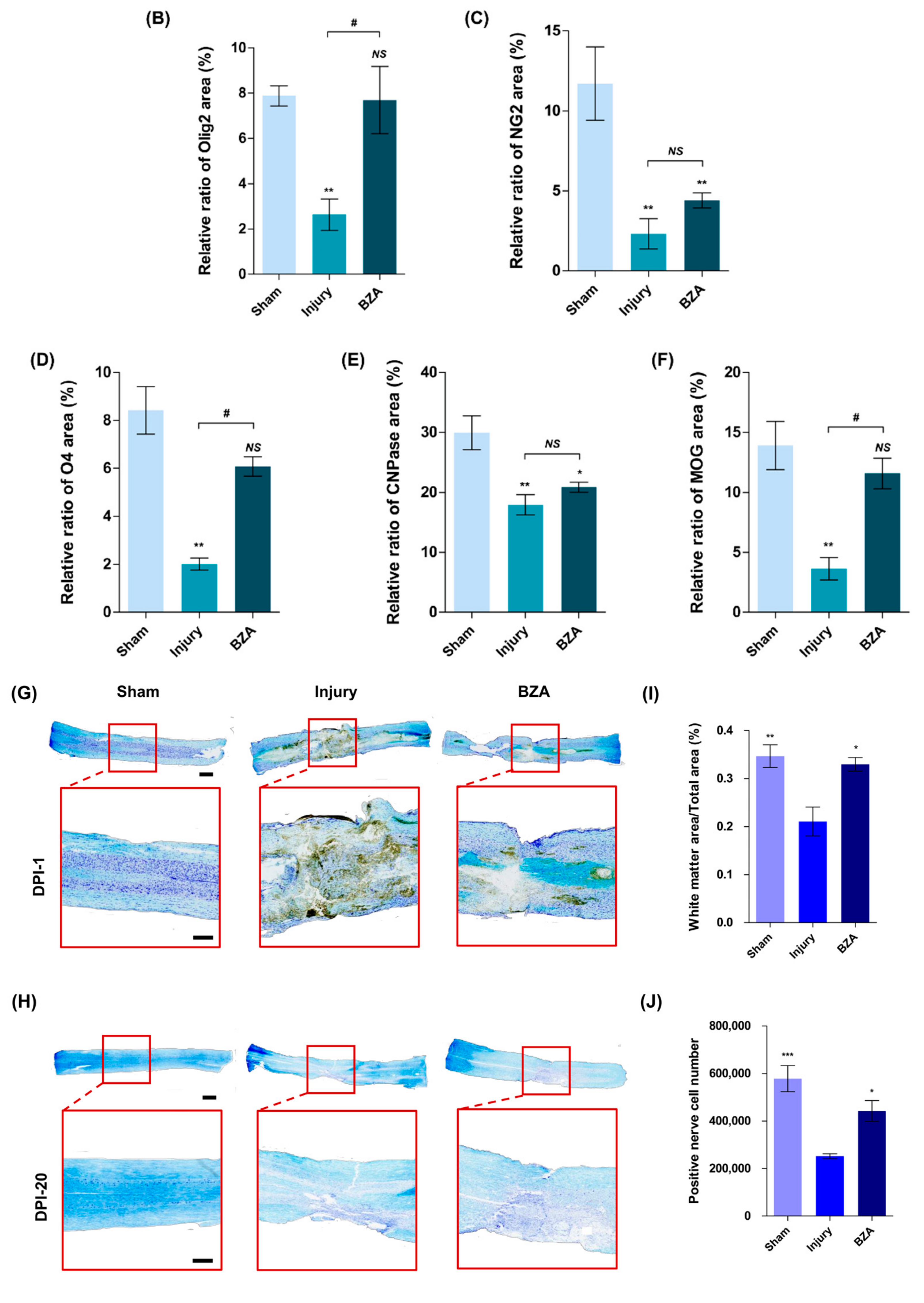 Ijms 22 11012 g006b 550