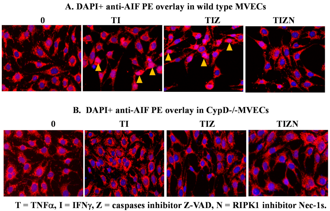 IJMS | Free Full-Text | Cyclophilin D Regulates the Nuclear 