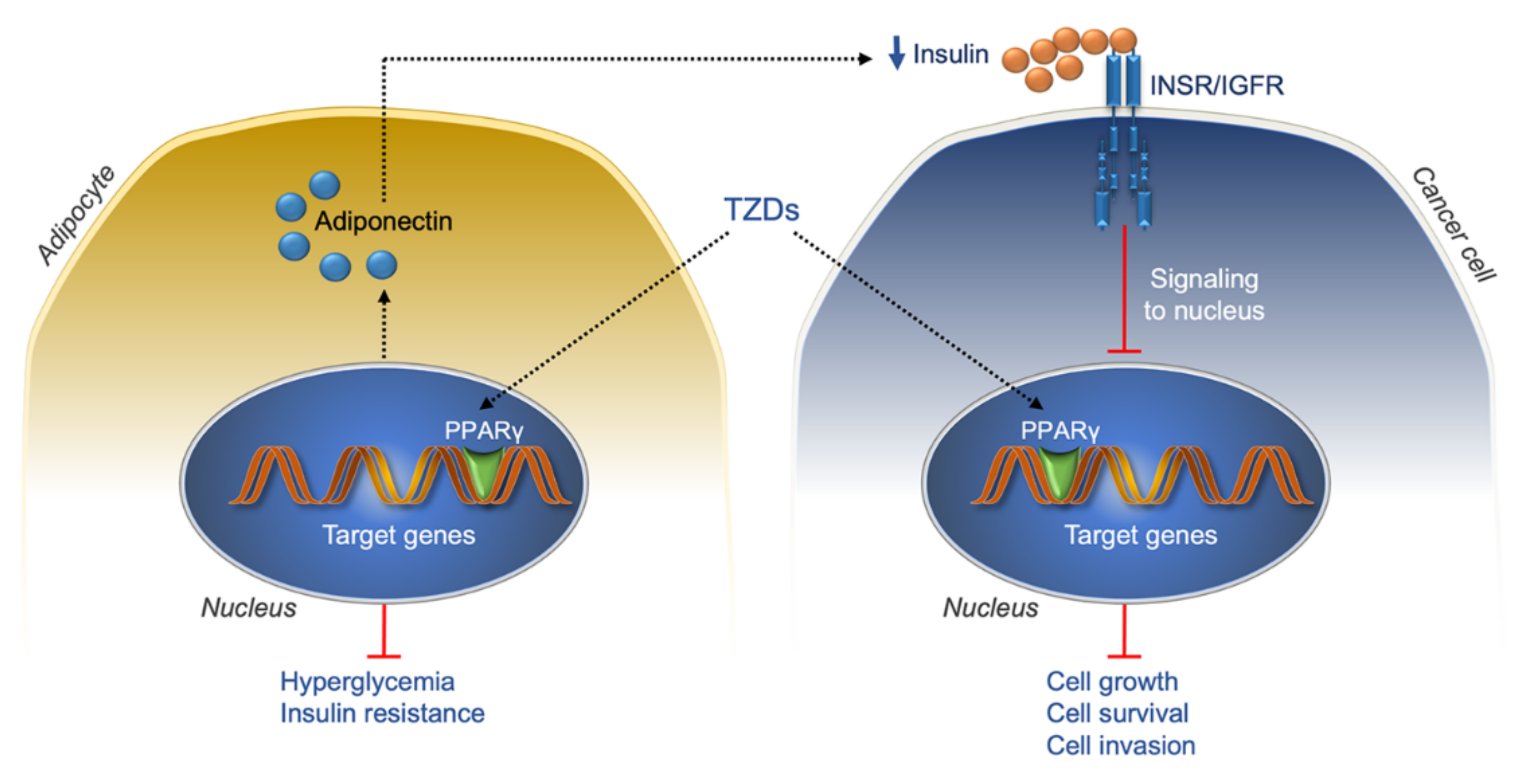 IJMS | Free Full-Text | Insulin Resistance and Cancer: In Search 