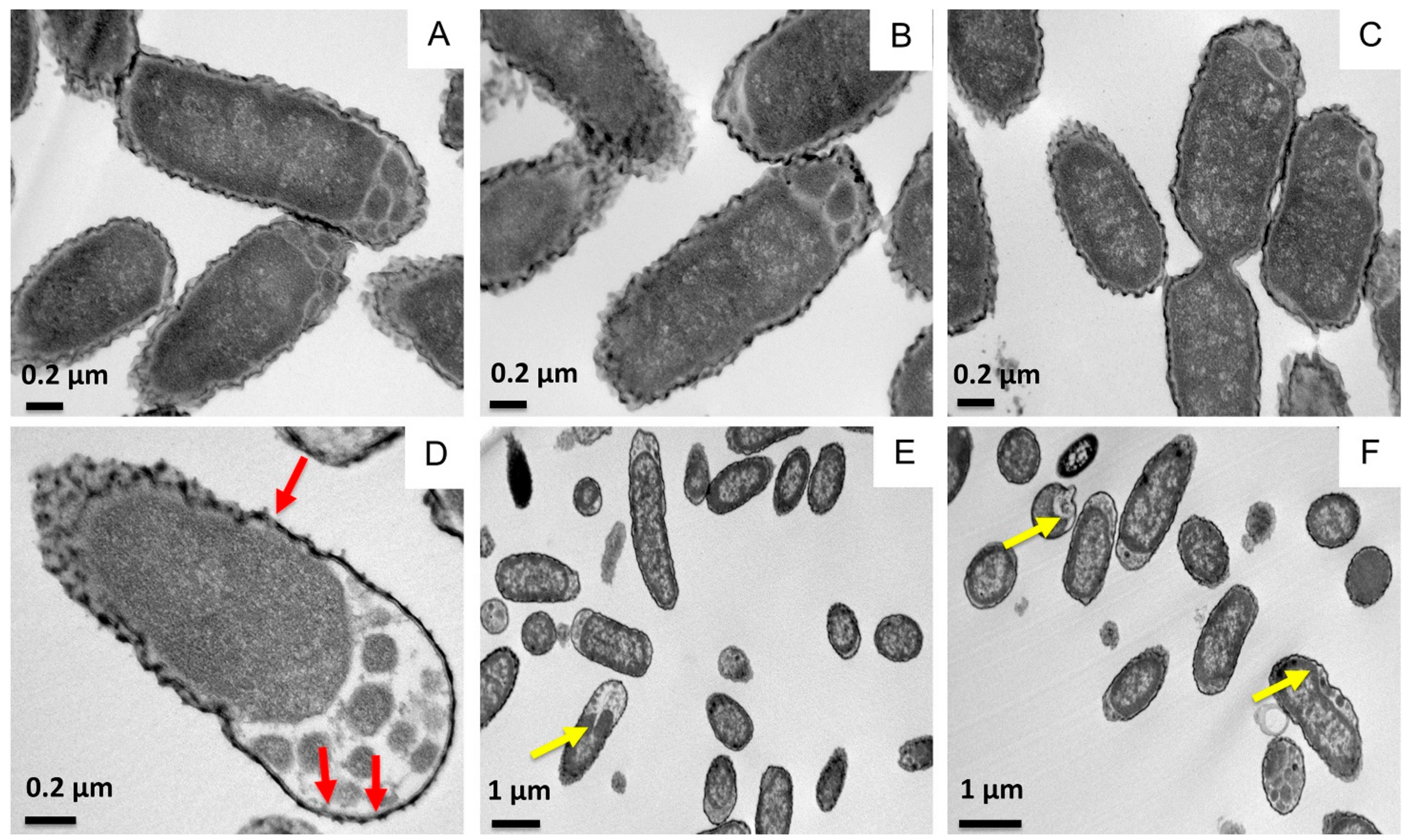 Ijms 22 11146 g003 Ijms 22 11146 g003