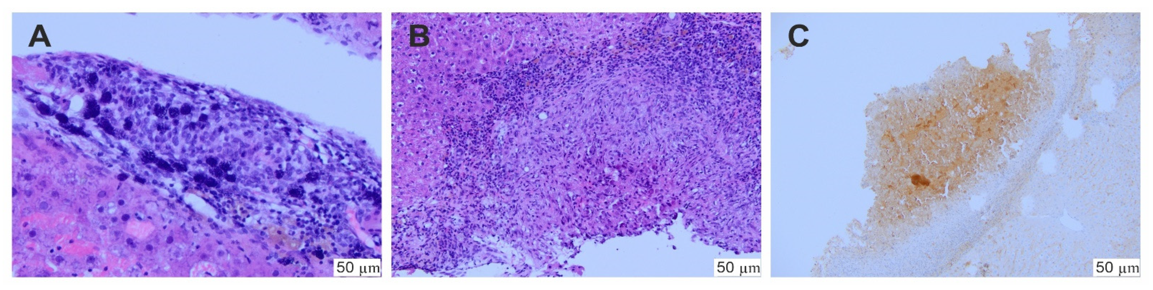 Ijms 22 11161 g007 550