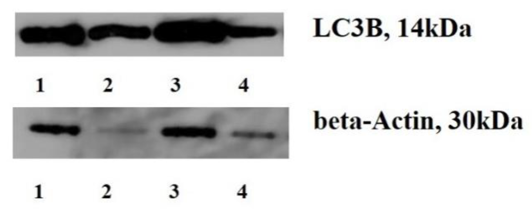 Ijms 22 11176 g001 550