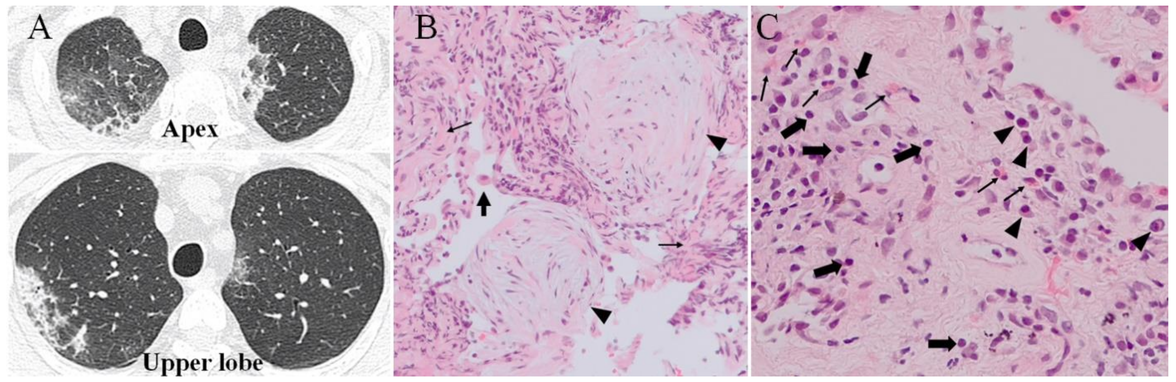 Ijms 22 11209 g001 550