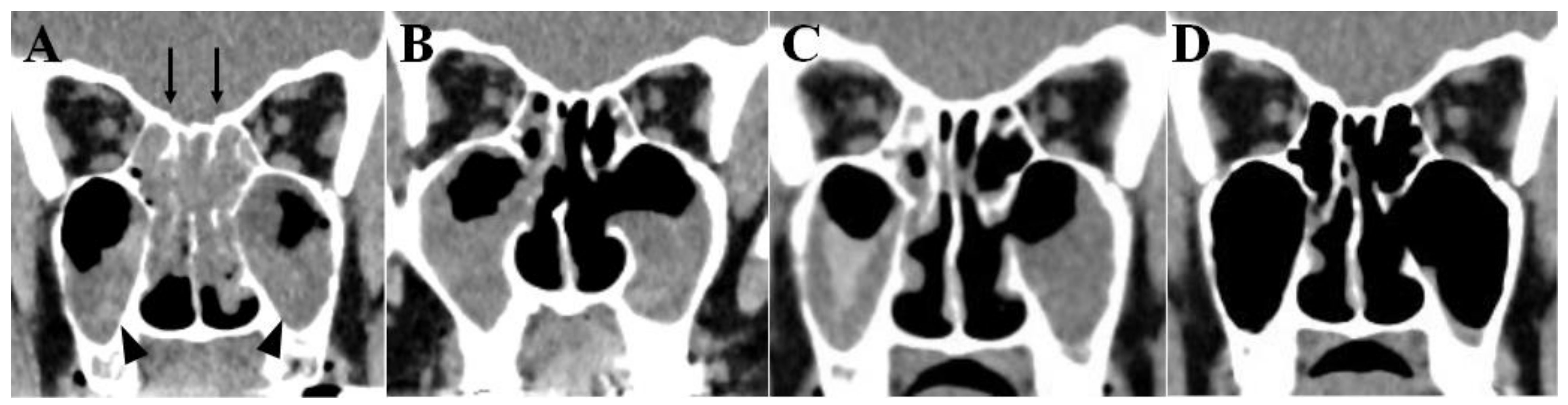 Ijms 22 11209 g003 550