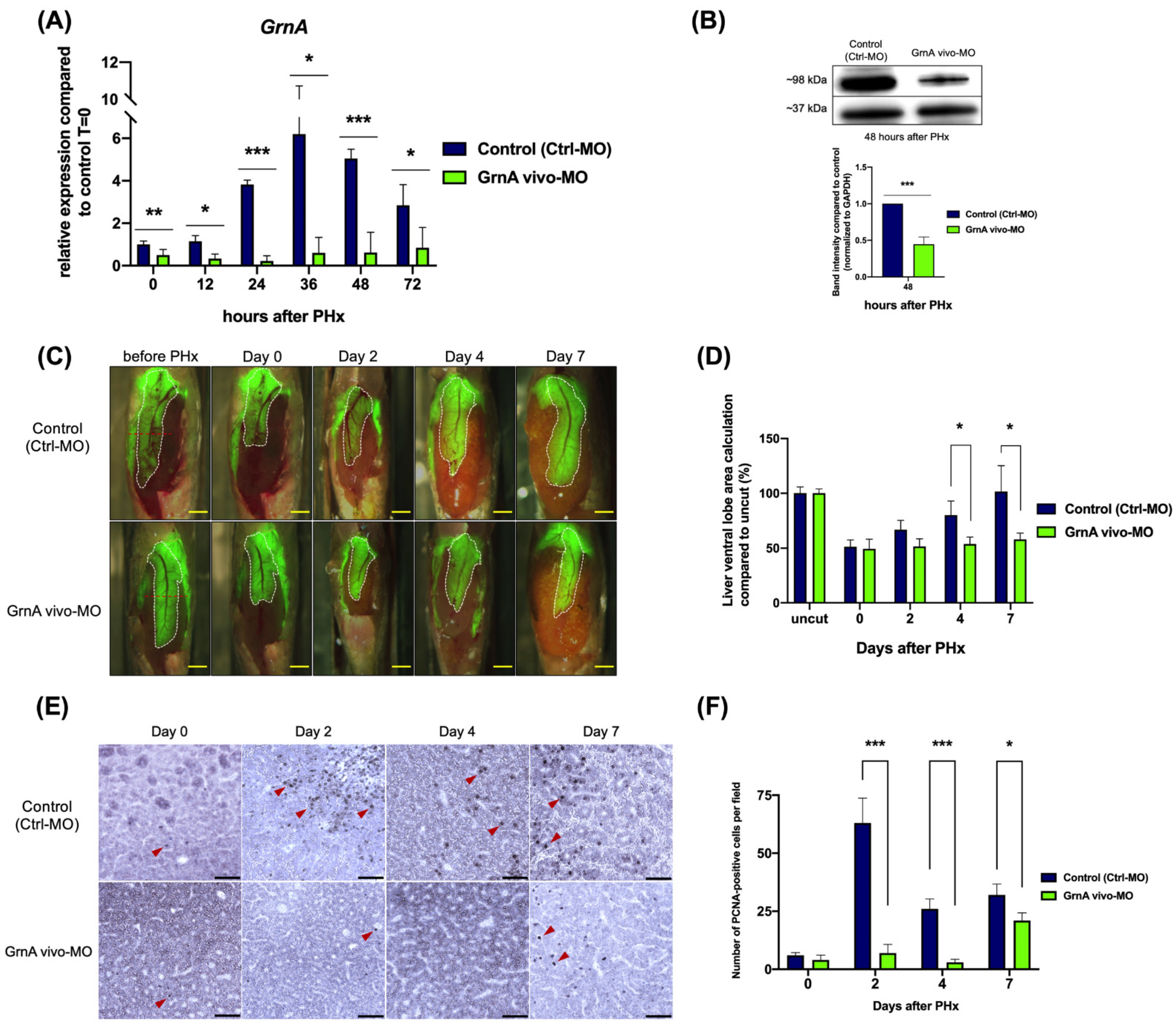Ijms 22 11217 g002 550
