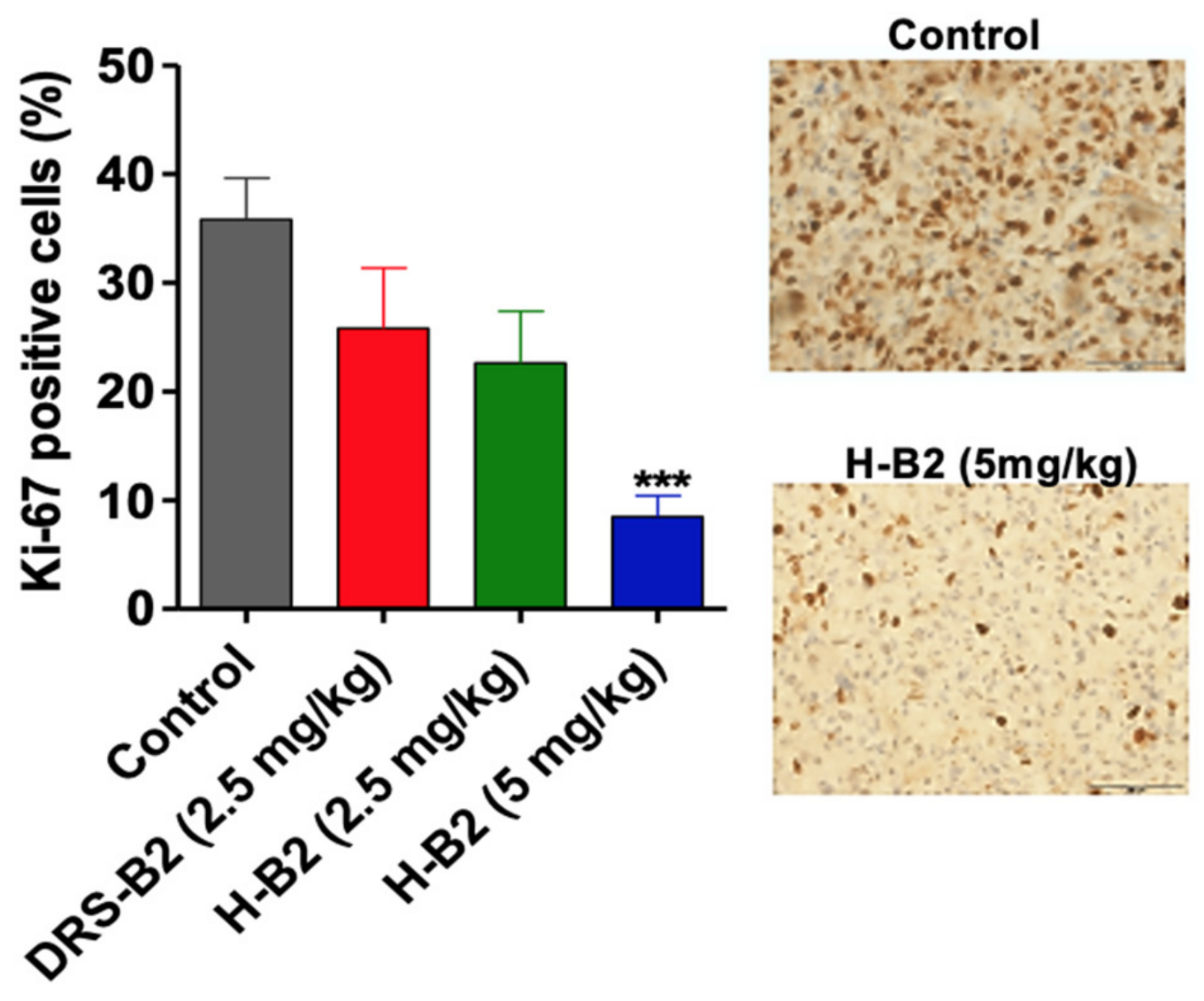 Ijms 22 11303 g005 550