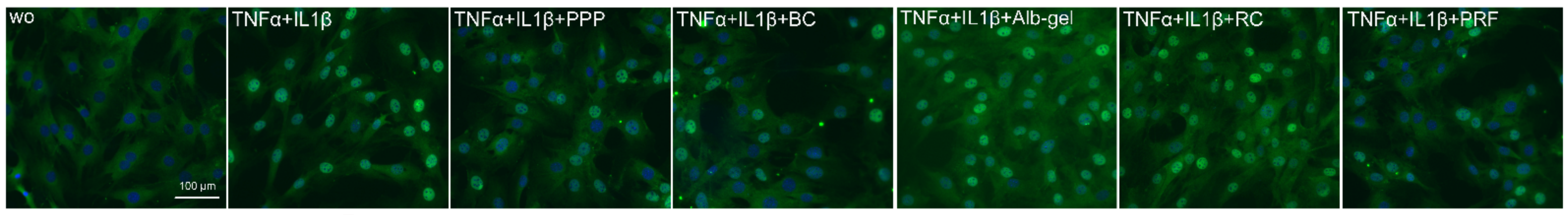 Ijms 22 11333 g007 550