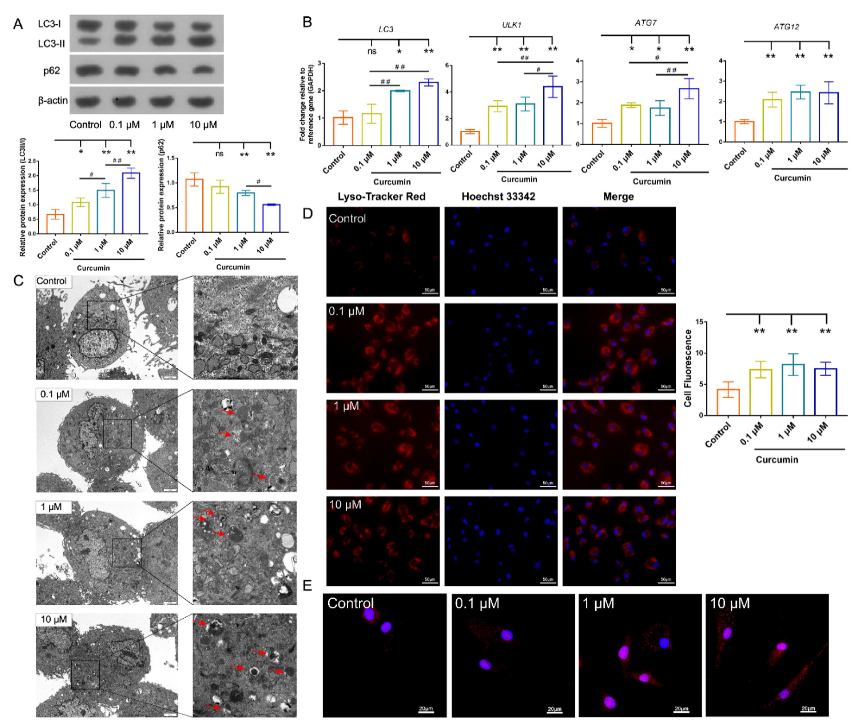 Ijms 22 11356 g004 Ijms 22 11356 g004