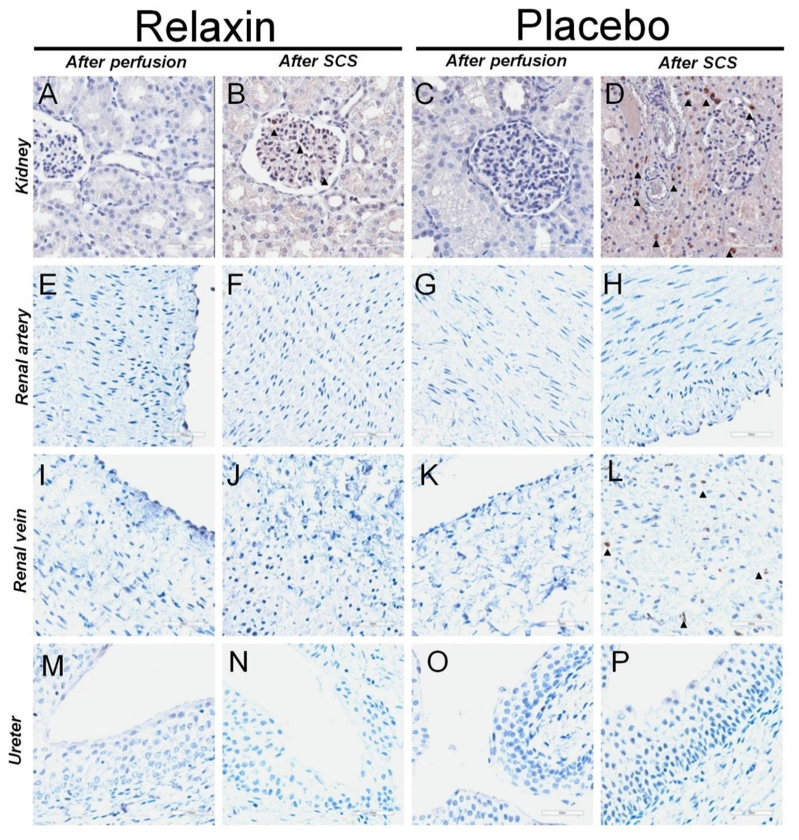 Ijms 22 11417 g005 550