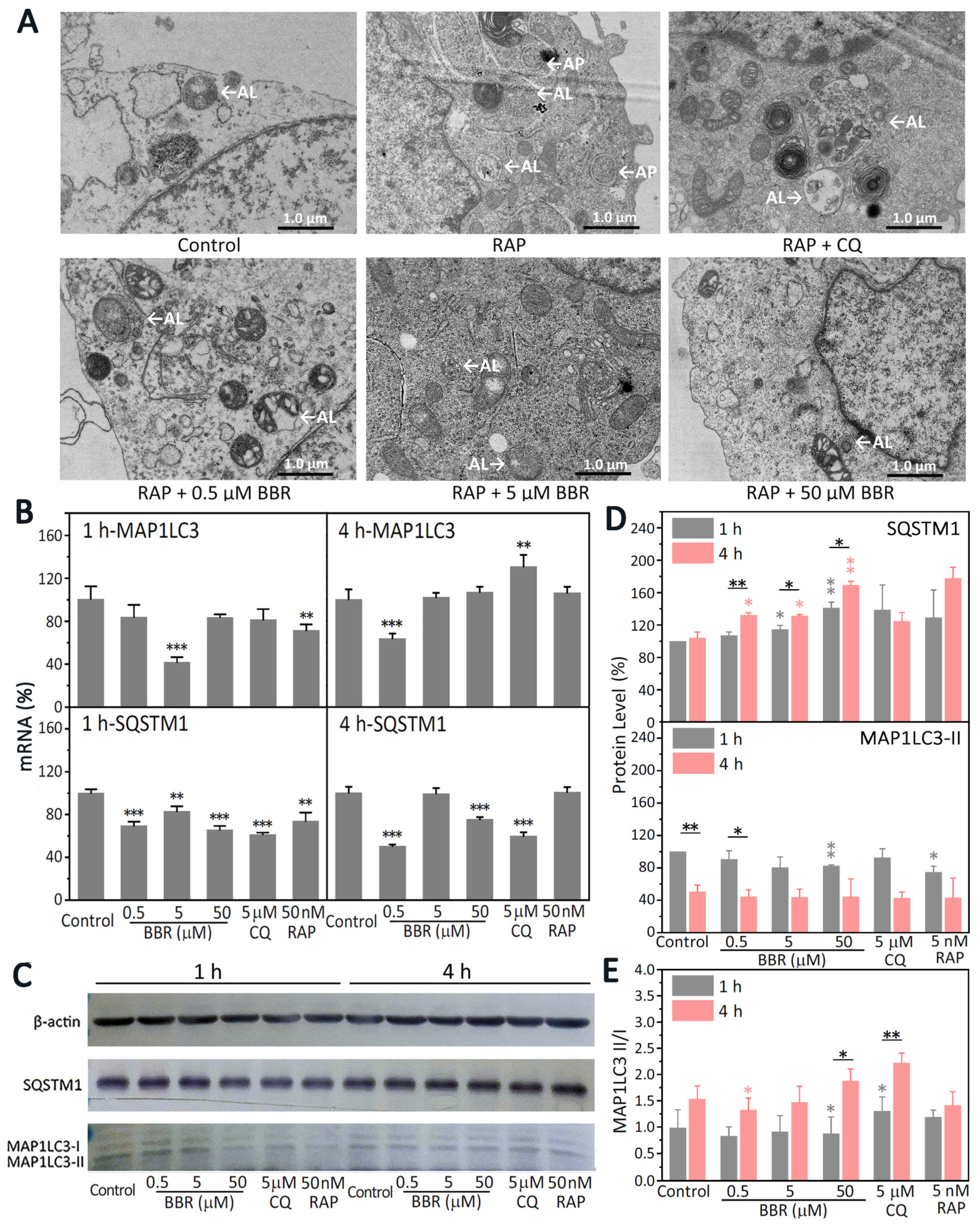 Ijms 22 11466 g004 550