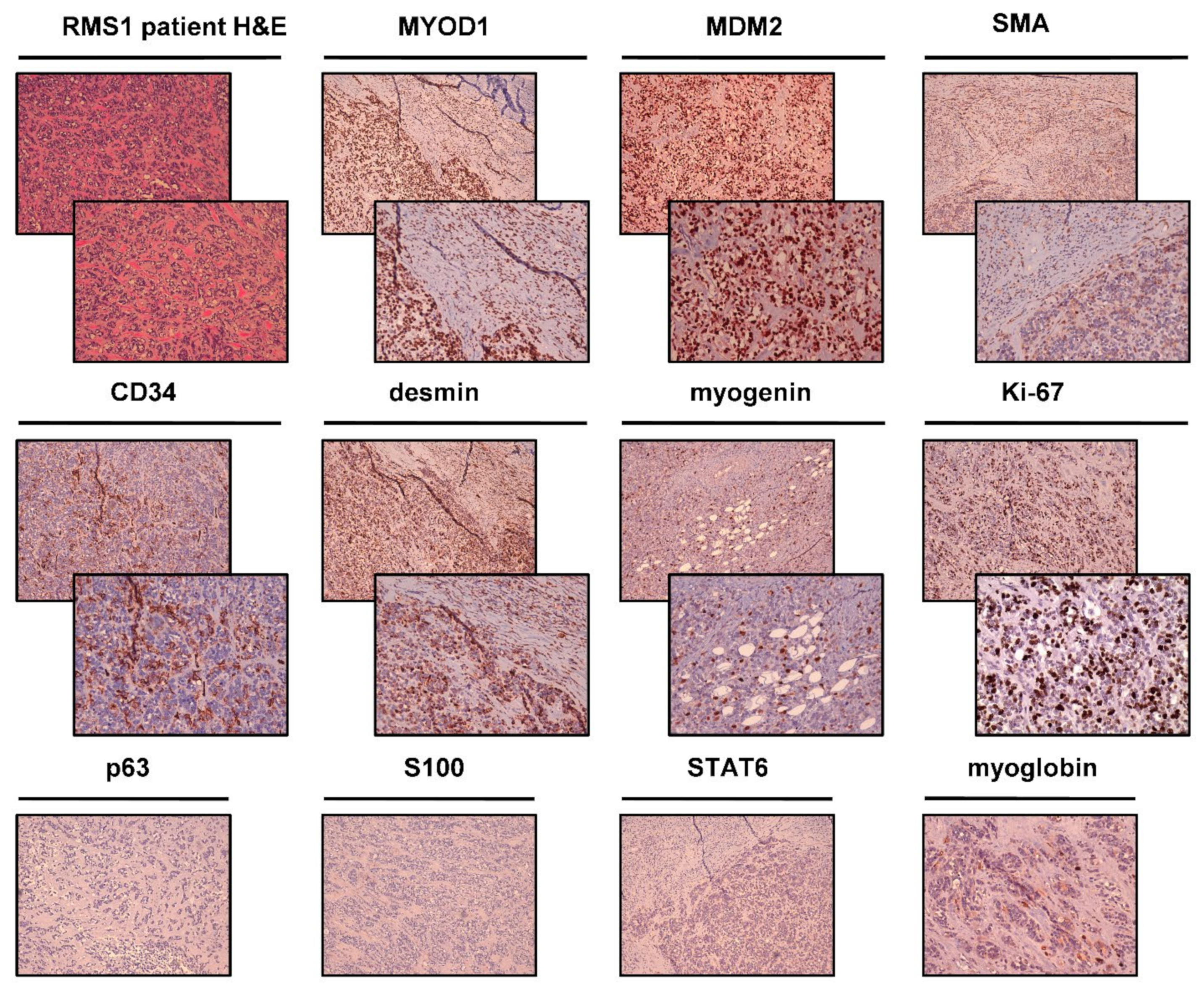 Deciphering the Genomic Landscape and Pharmacological