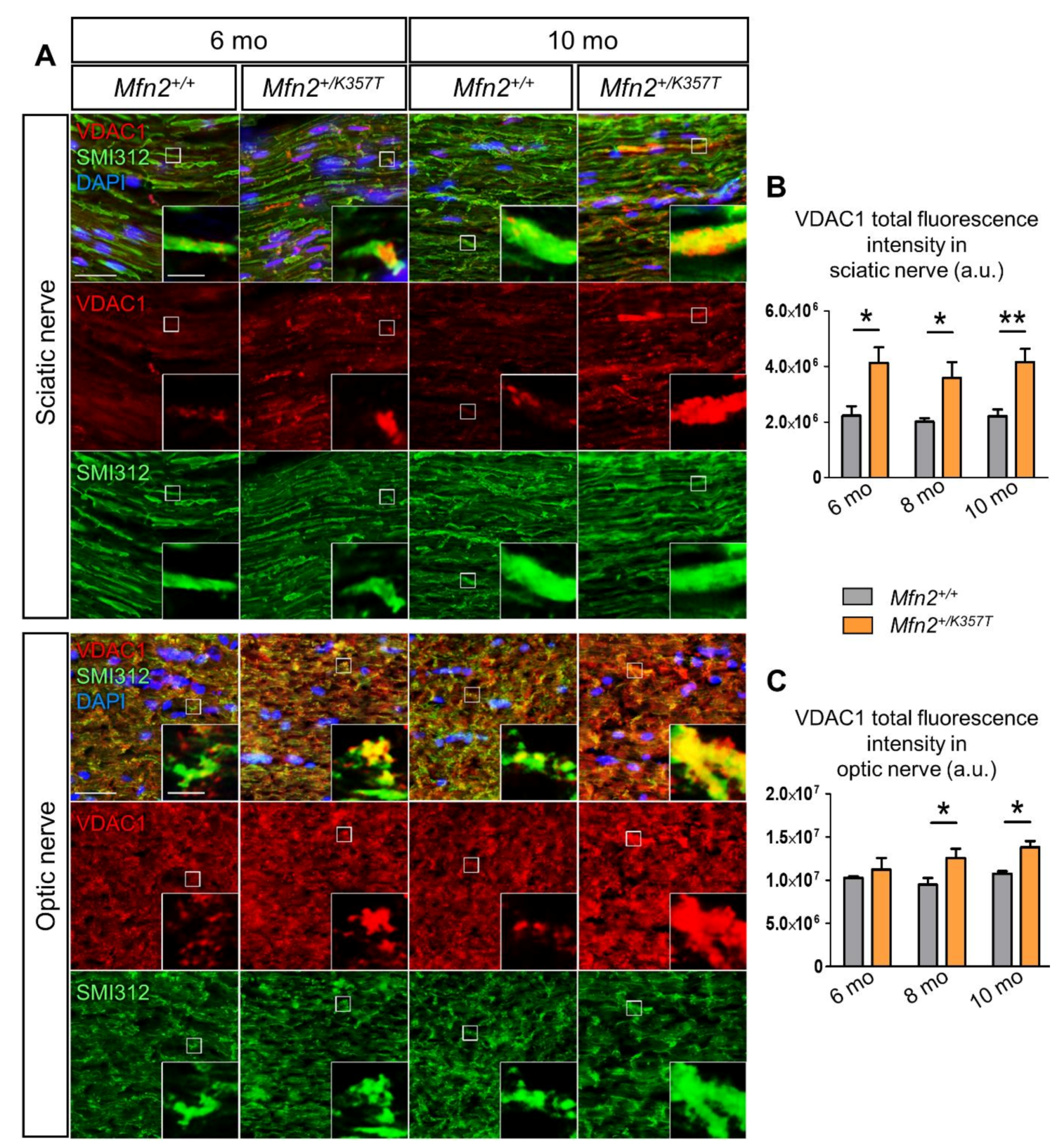 Ijms 22 11569 g003 550