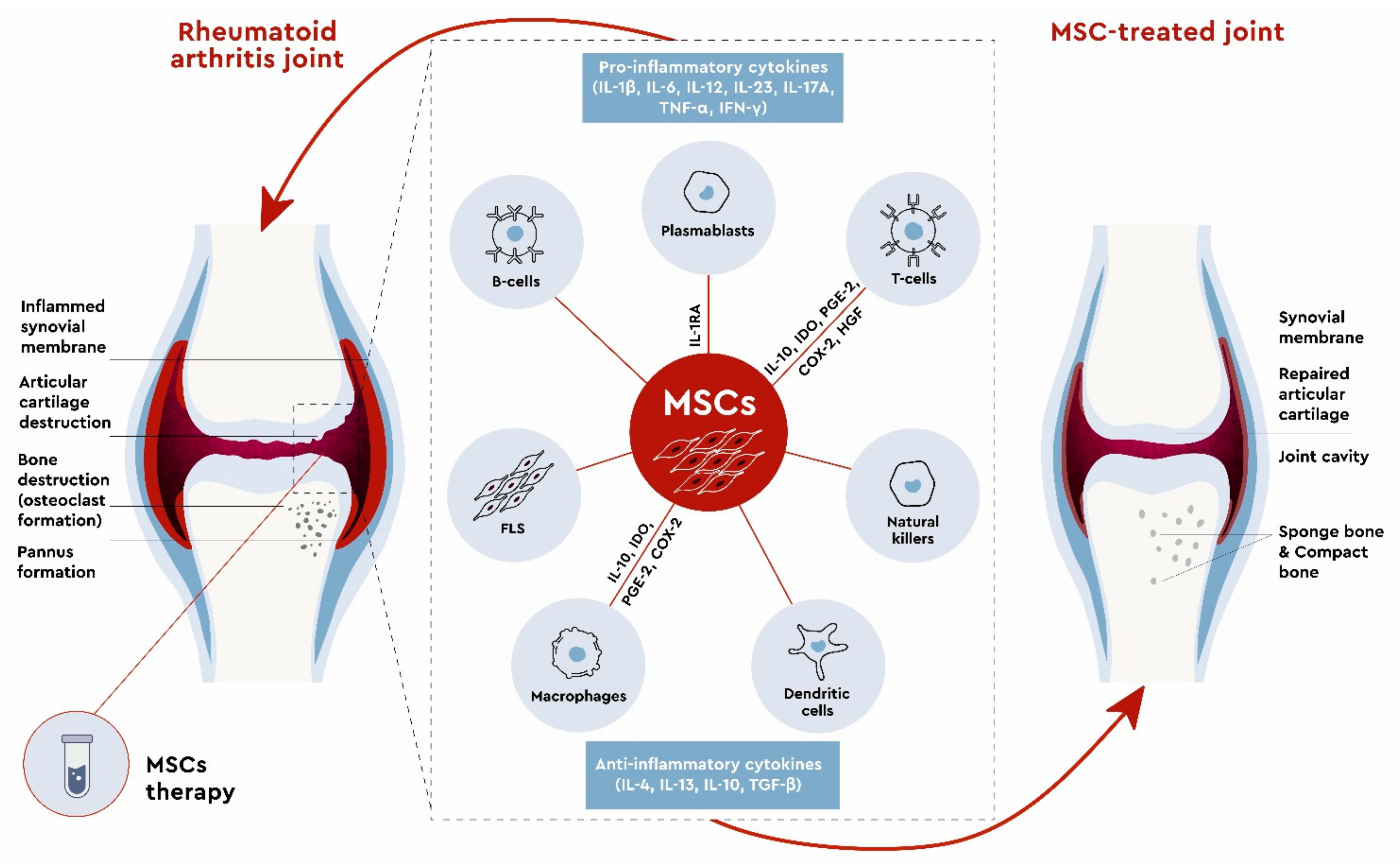 Stem Cell Therapy  Cellular Injections for Chronic Joint Pain