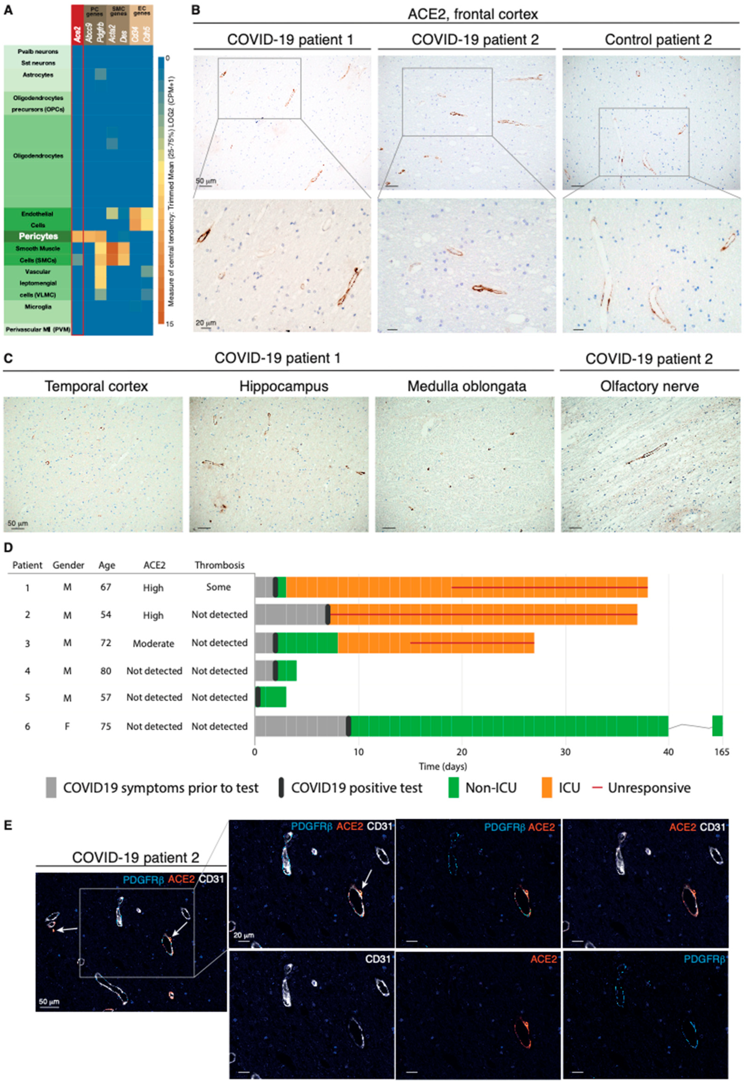 dommer Creek Fjerde IJMS | Free Full-Text | Infection of Brain Pericytes Underlying  Neuropathology of COVID-19 Patients | HTML