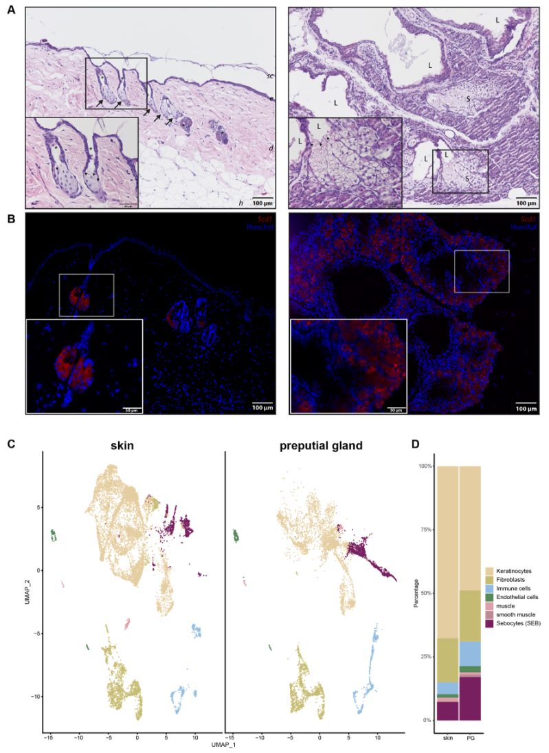 IJMS | Free Full-Text | Transcriptional Differences in Lipid 