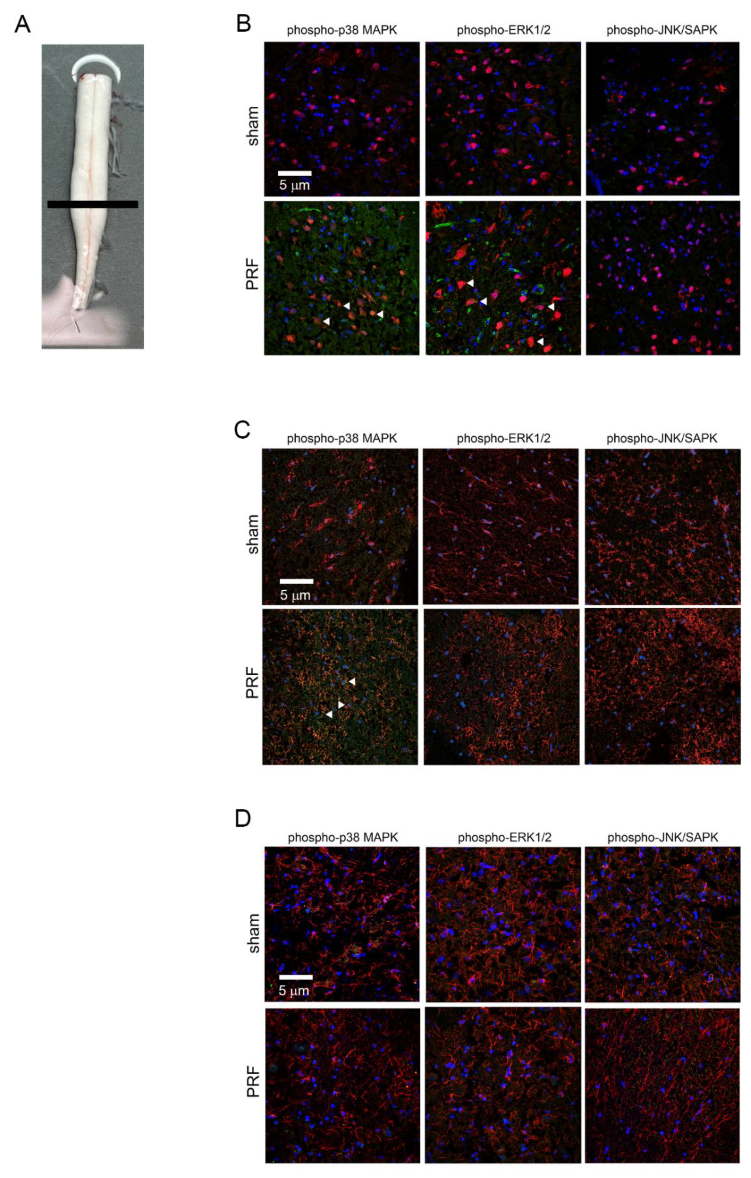 Ijms 22 11865 g004 550
